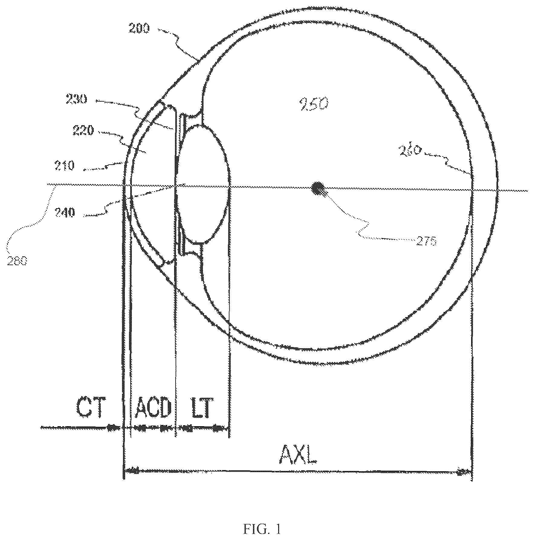 Patent US12551332 Figure 1 – Piggyback intraocular lens that improves overall vision where there is a local loss of retinal function