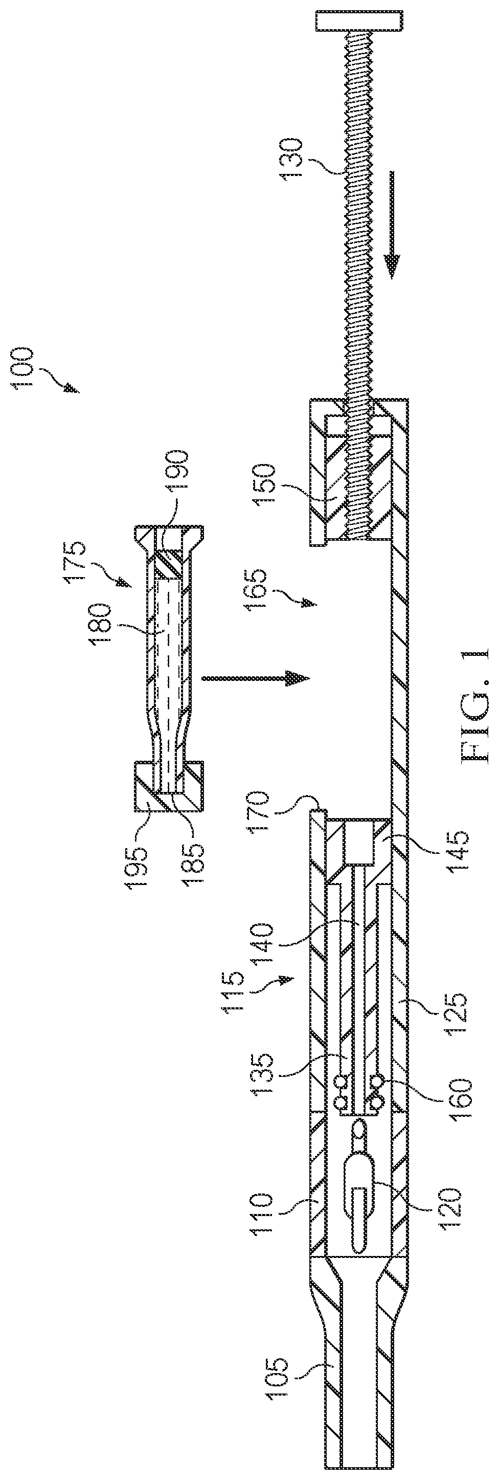 Patent US12551335 — Hydraulic delivery of surgical implants — Figure 1