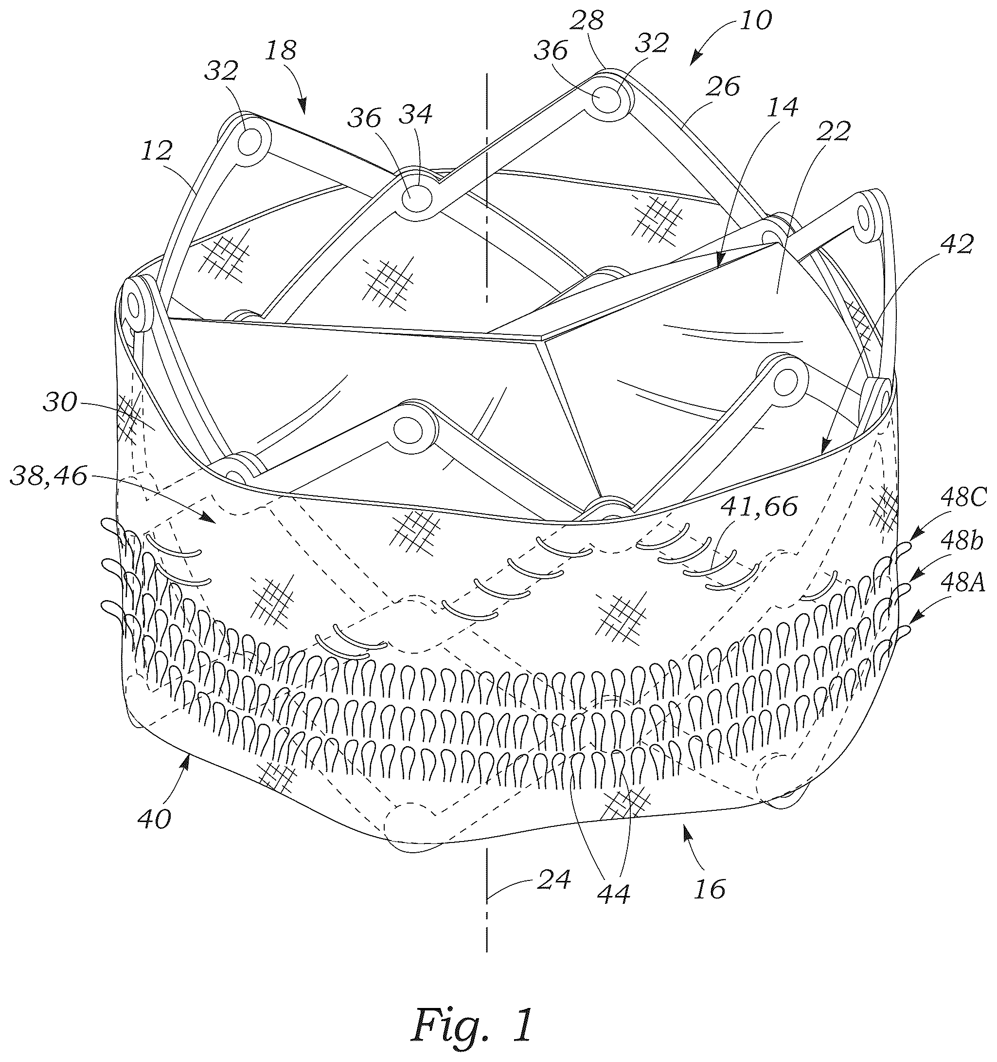 Patent US12551336 — Sealing element for prosthetic heart valve — Figure 1