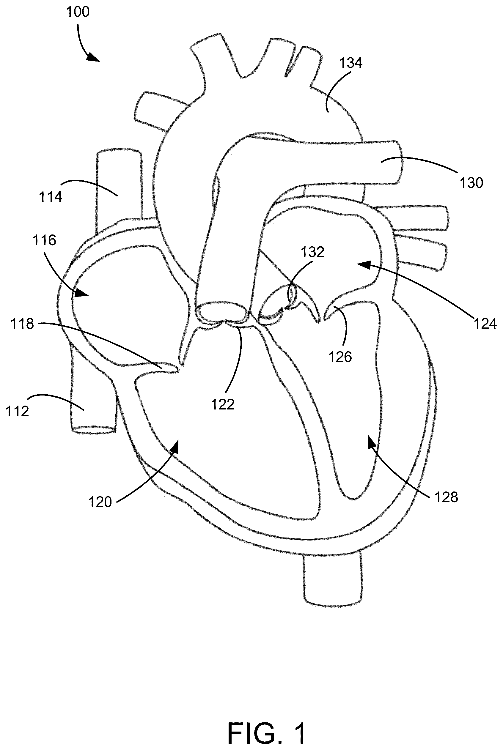 Patent US12551341 — Heart valve clip — Figure 1