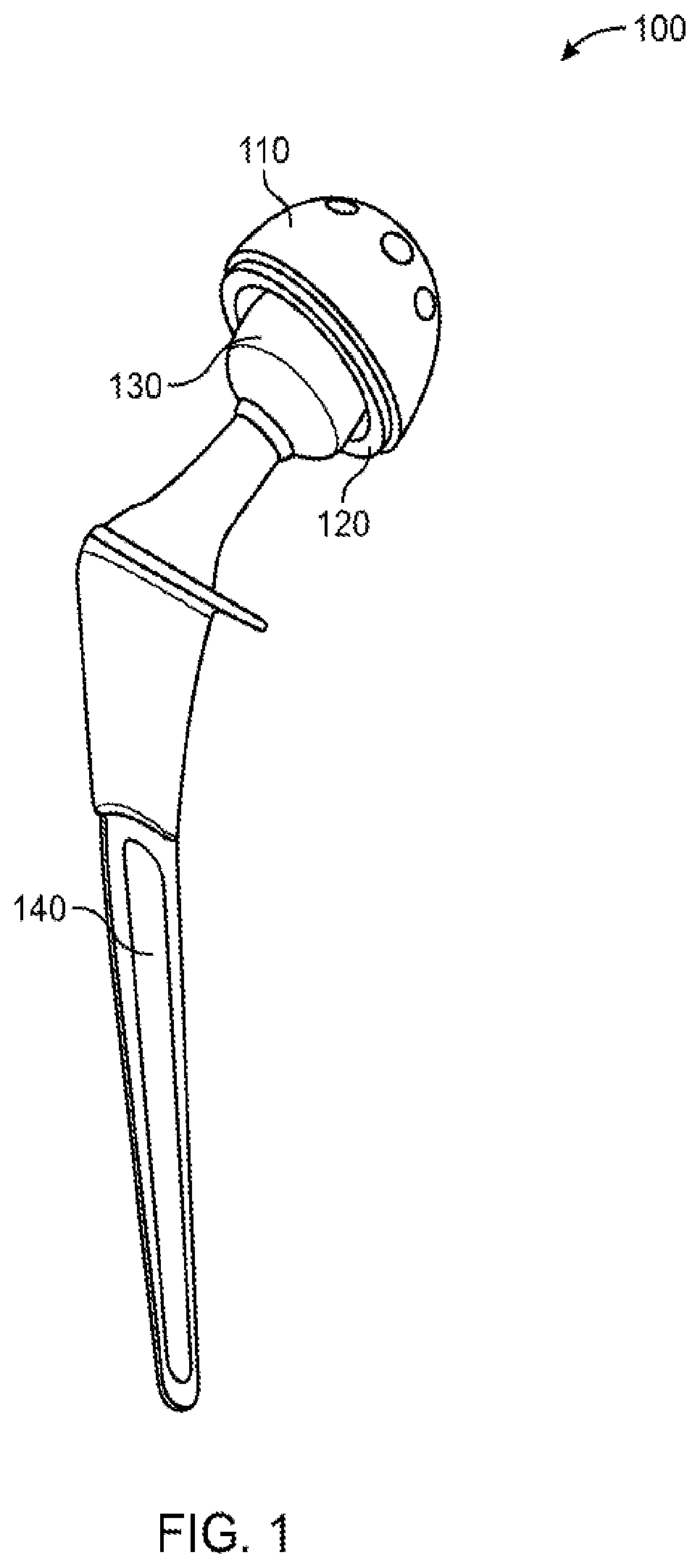 Patent US12551347 — Apparatus and method for forming a custom cement-on-cement articulating hip spacer — Figure 1