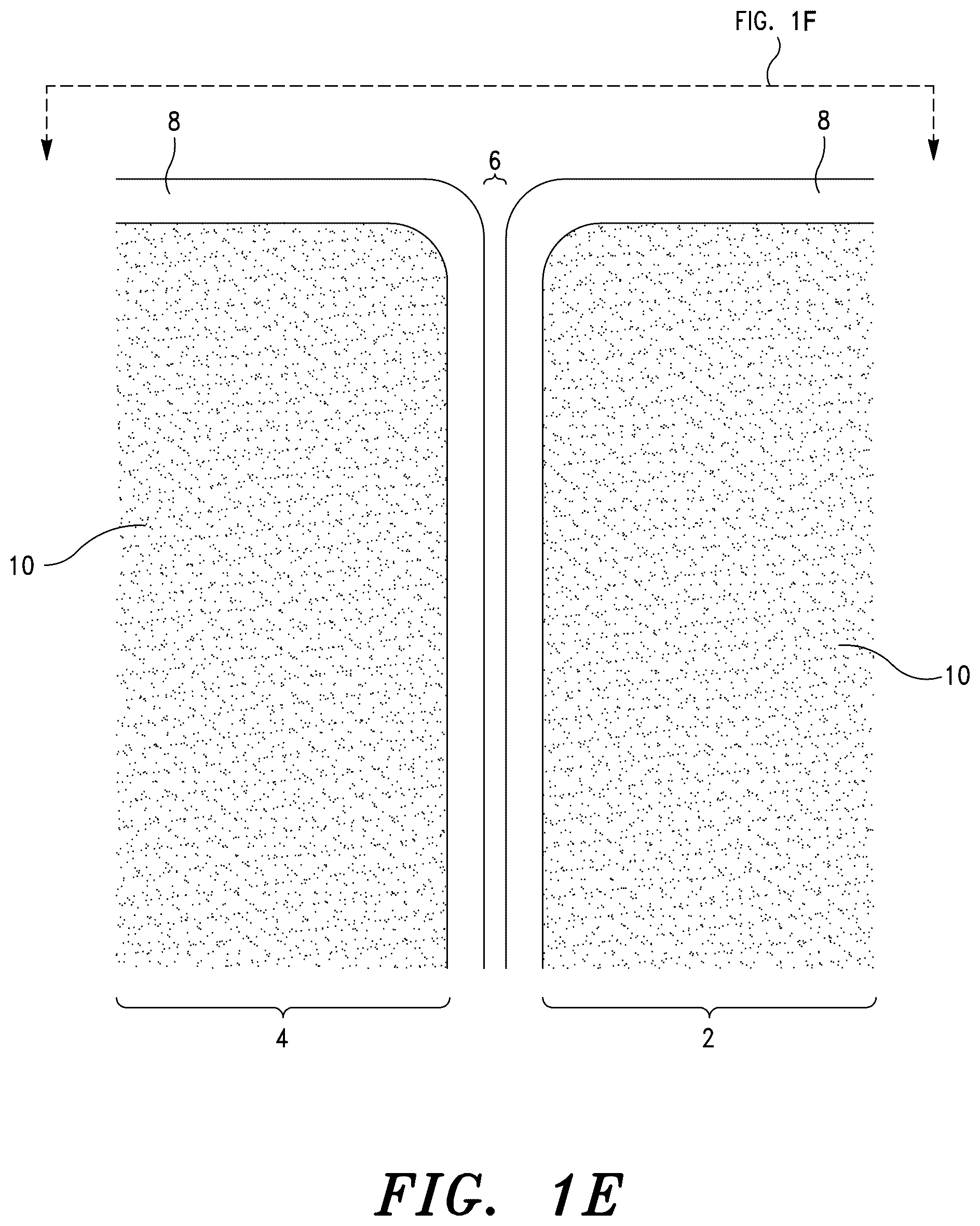 Patent US12551348 Figure 4 – Systems for sacroiliac joint stabilization