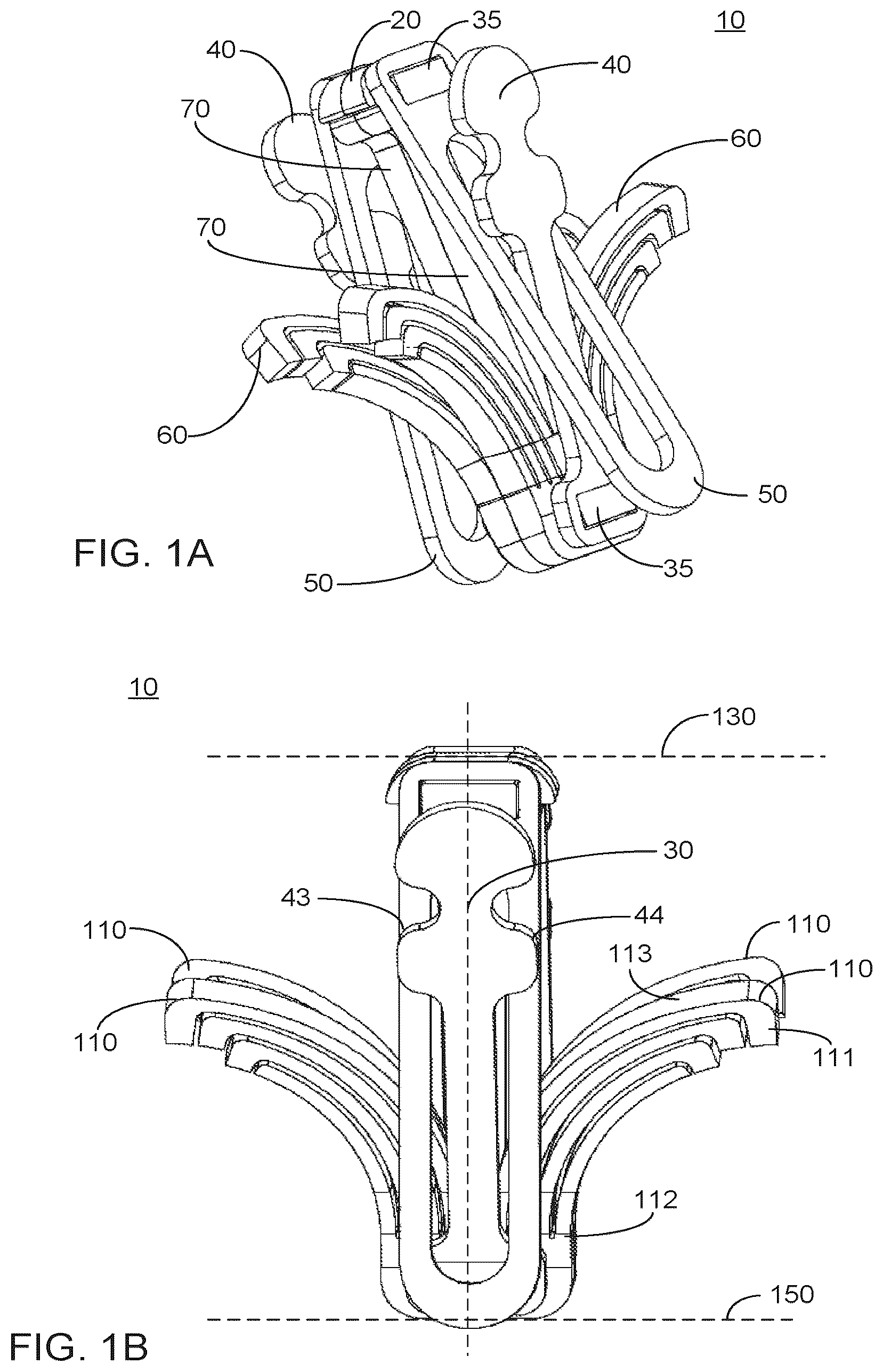 Patent US12551351 — Implant — Figure 1