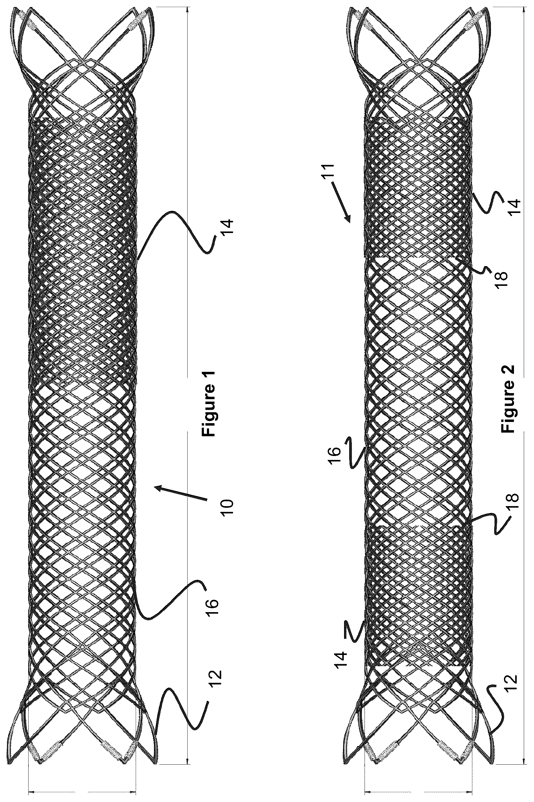 Patent US12551357 — Stent — Figure 1