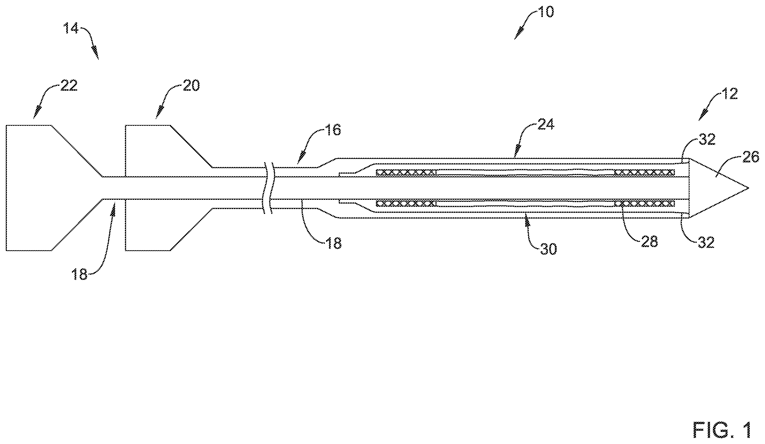 Patent US12551360 Figure 1 – Stent delivery system