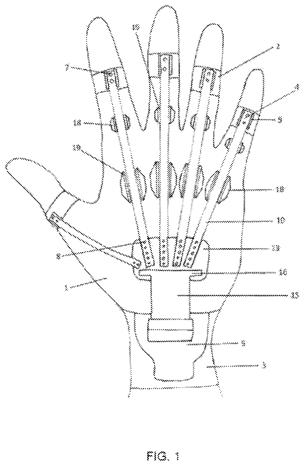Patent US12551363 — Hand-and-wrist accessory device for people that facilitates extension movements — Figure 1