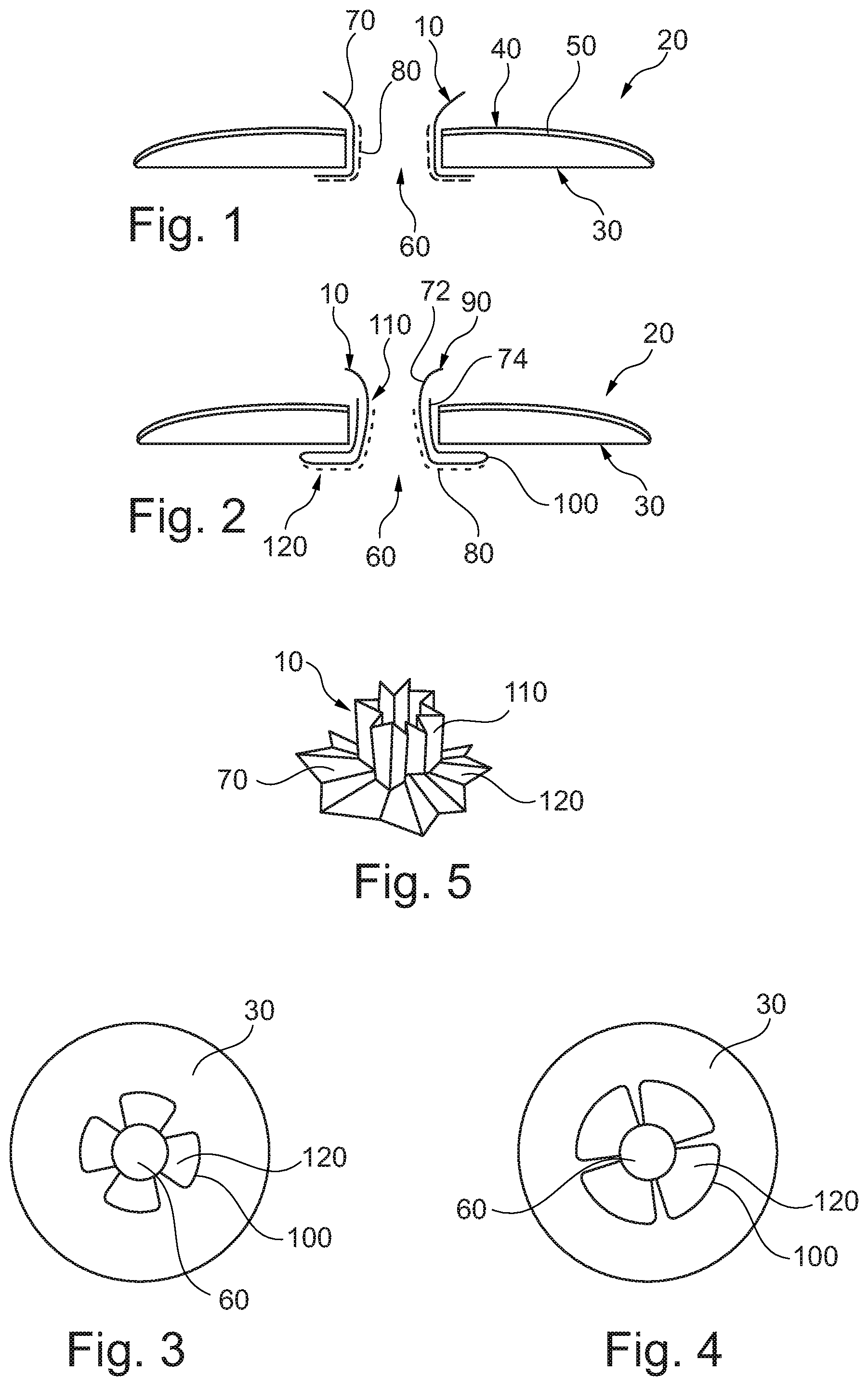 Patent US12551365 Figure 1 – Application aid for ostomy device