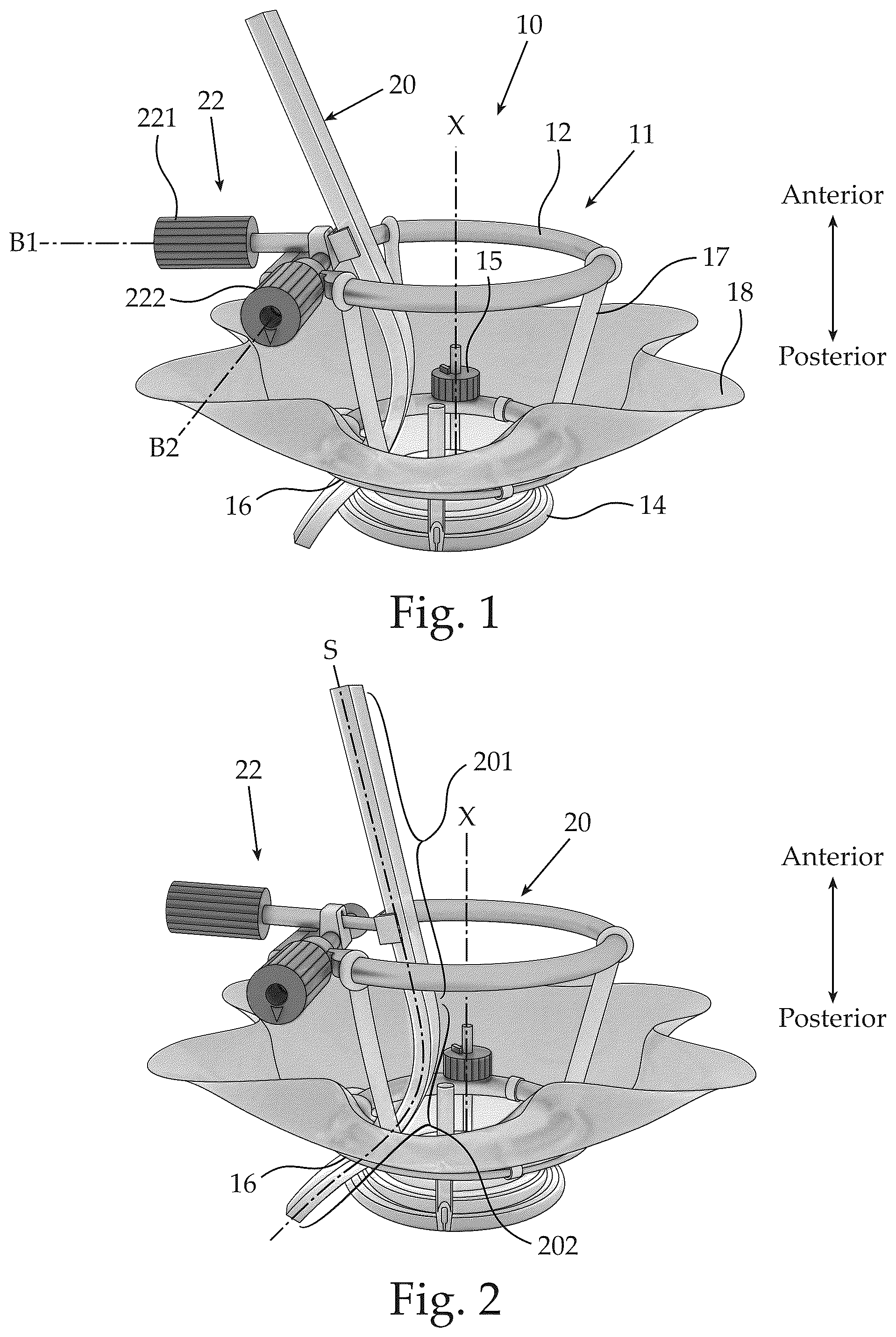 Patent US12551370 — Ocular platforms and surgical tools — Figure 1