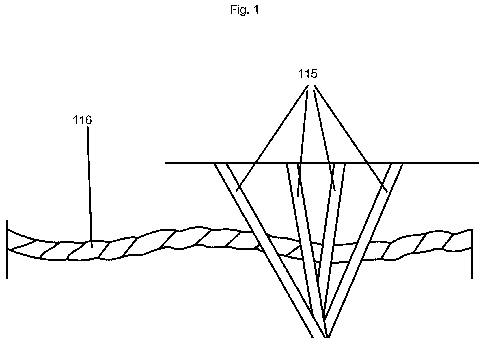 Patent US12551373 Figure 1 – Vitrectomy device