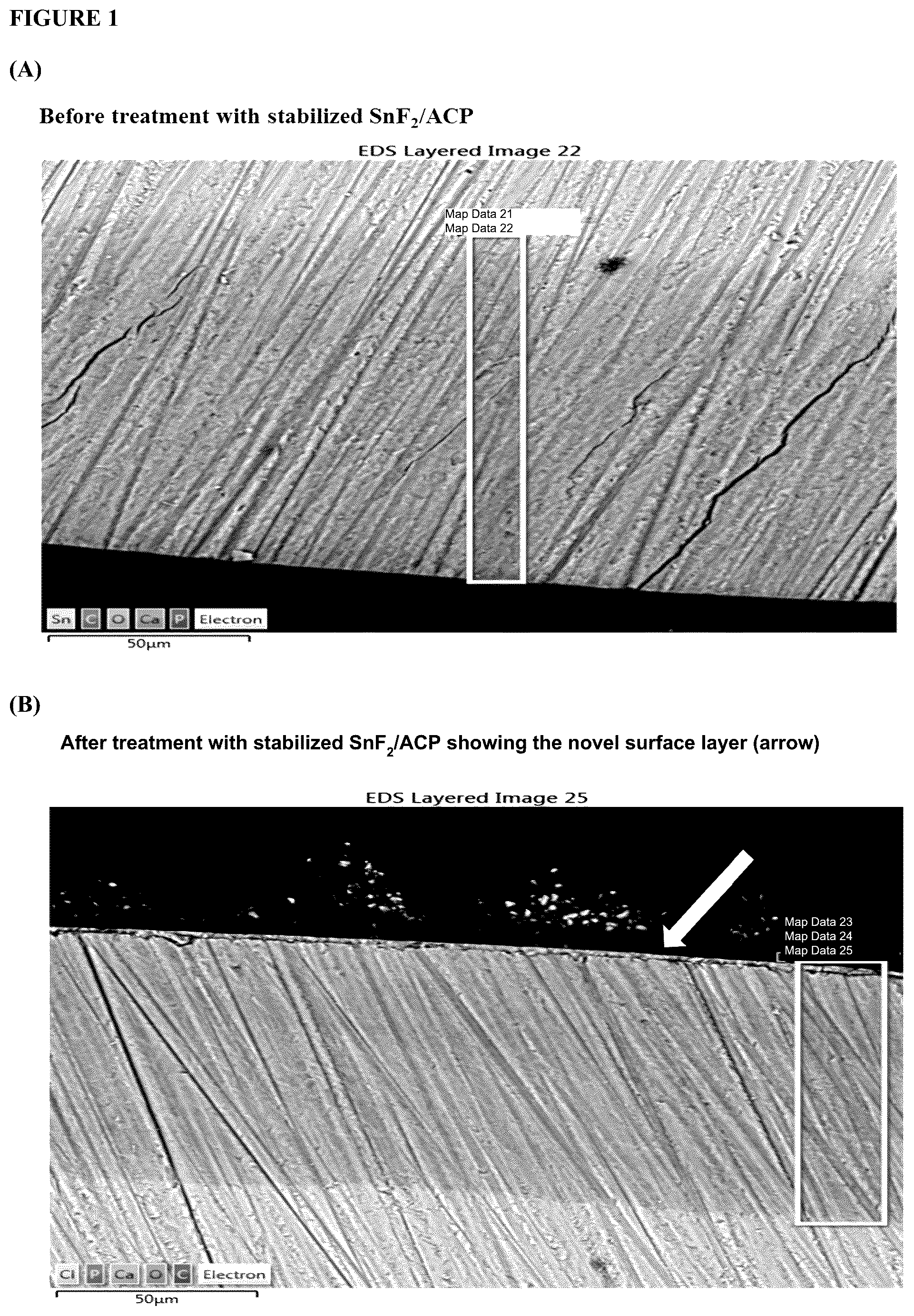 Patent US12551417 — Stabilized stannous compositions — Figure 1