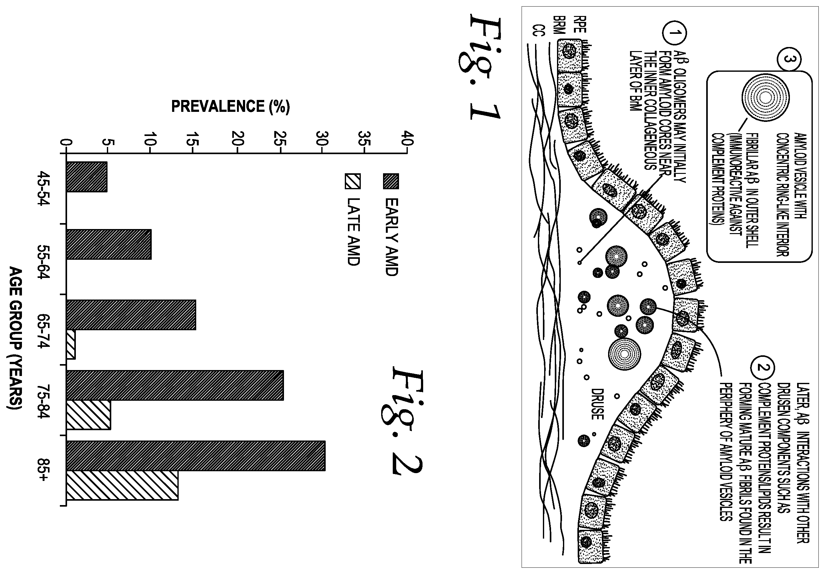 Patent US12551453 — Compositions and methods of treating age-related macular degeneration — Figure 1