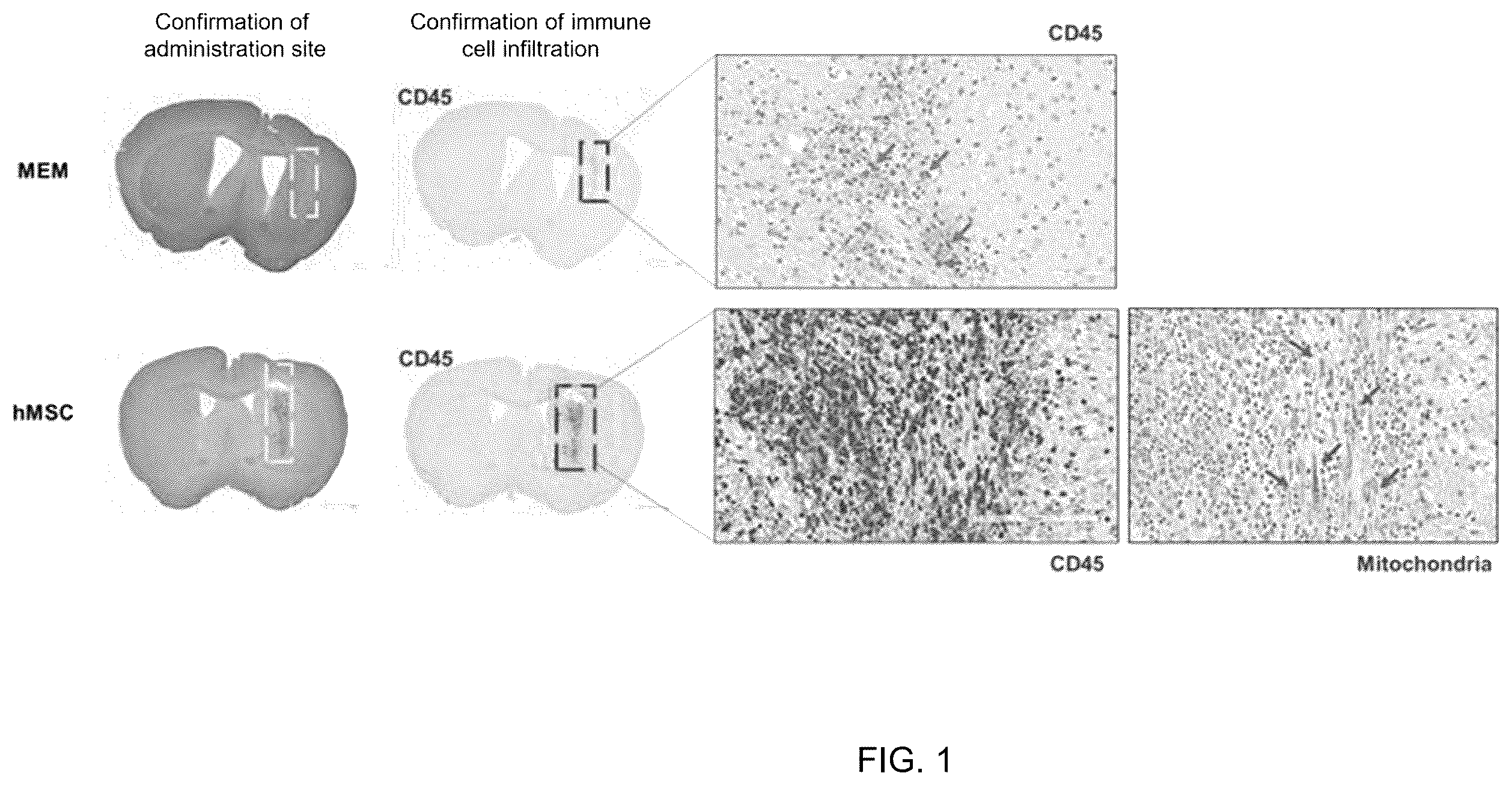 Patent US12551493 — Composition for enhancing therapeutic effect of stem cell, comprising immunosuppressant, and method for enhancing therapeutic effect of stem cell using same — Figure 1