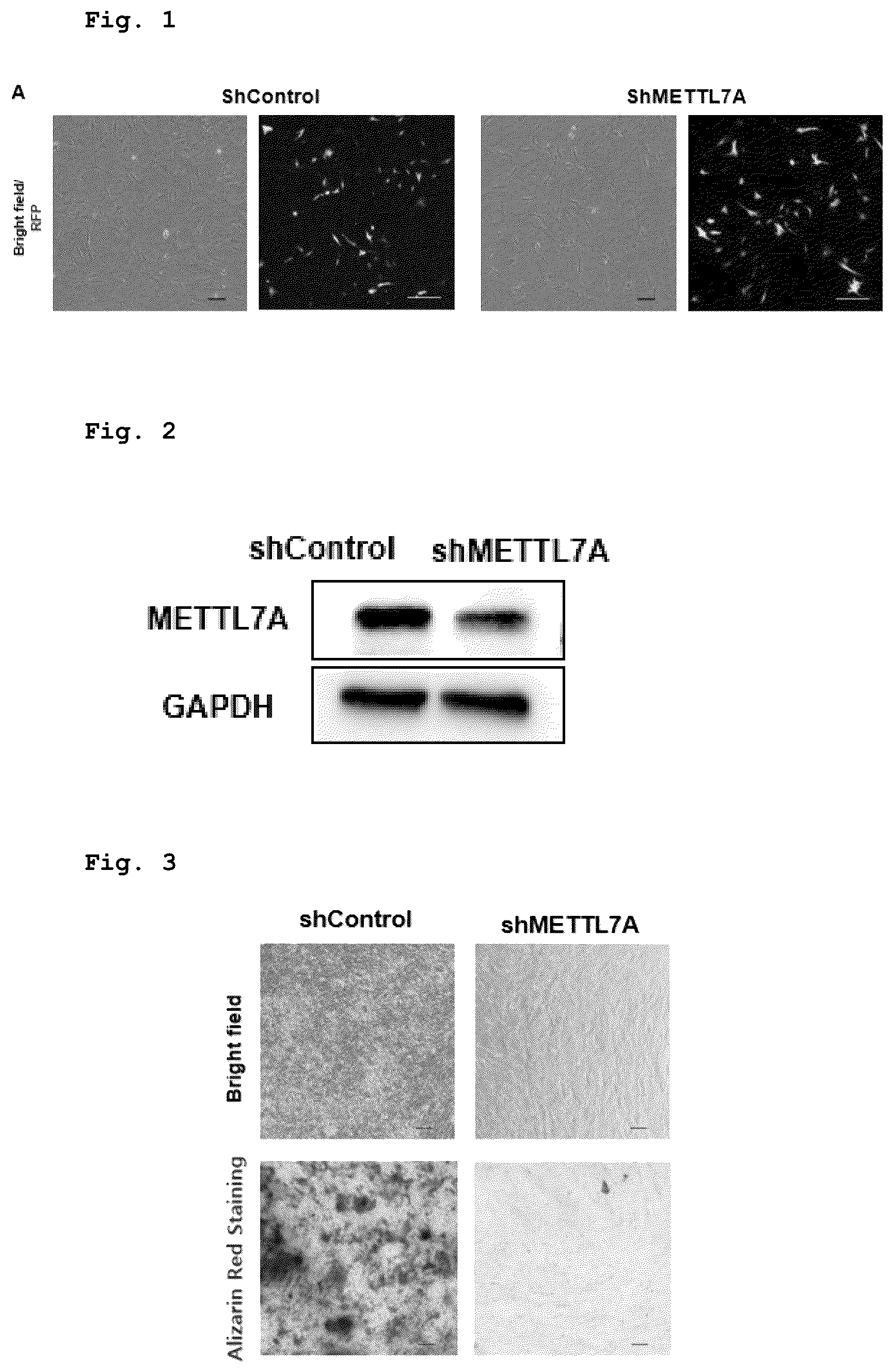 Patent US12551505 — Composition for bone regeneration comprising METTL7A overexpressing stem cells, method for preparing same, and cell therapy product comprising same — Figure 1