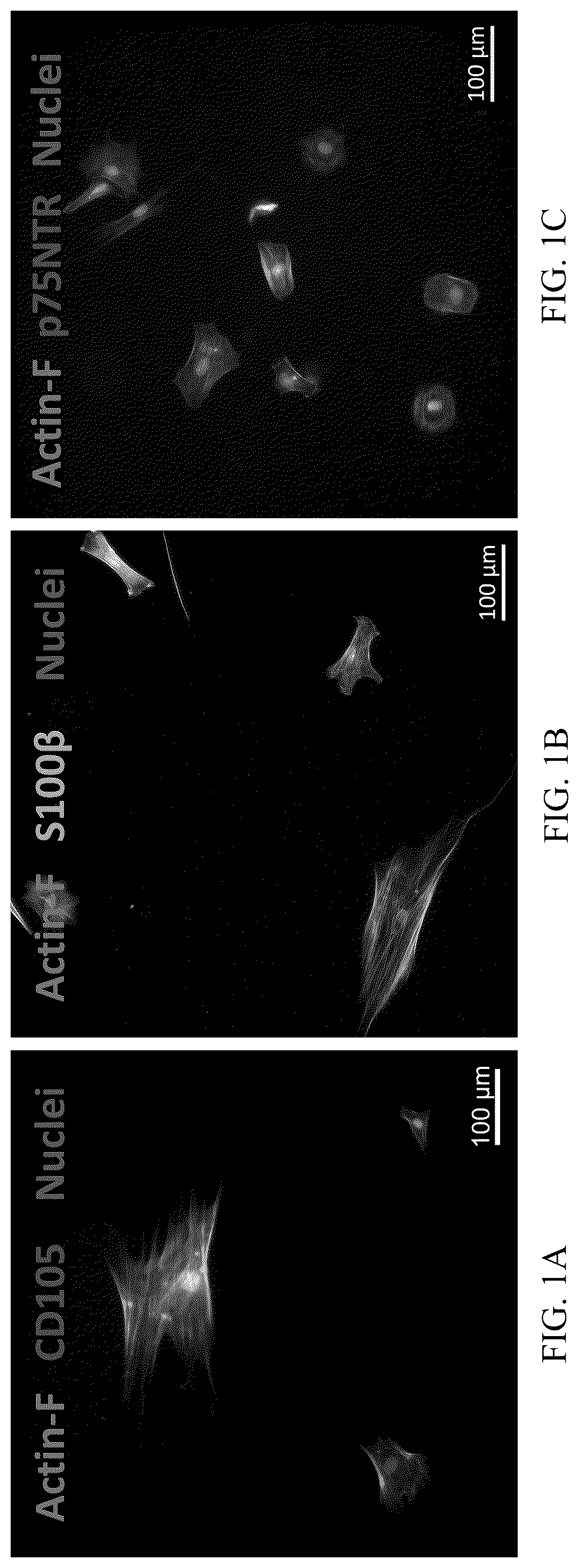 Patent US12551506 Figure 1 – Differentiation of olfactory mucosa derived mesenchymal stem cells to schwann cells for peripheral nerve repair