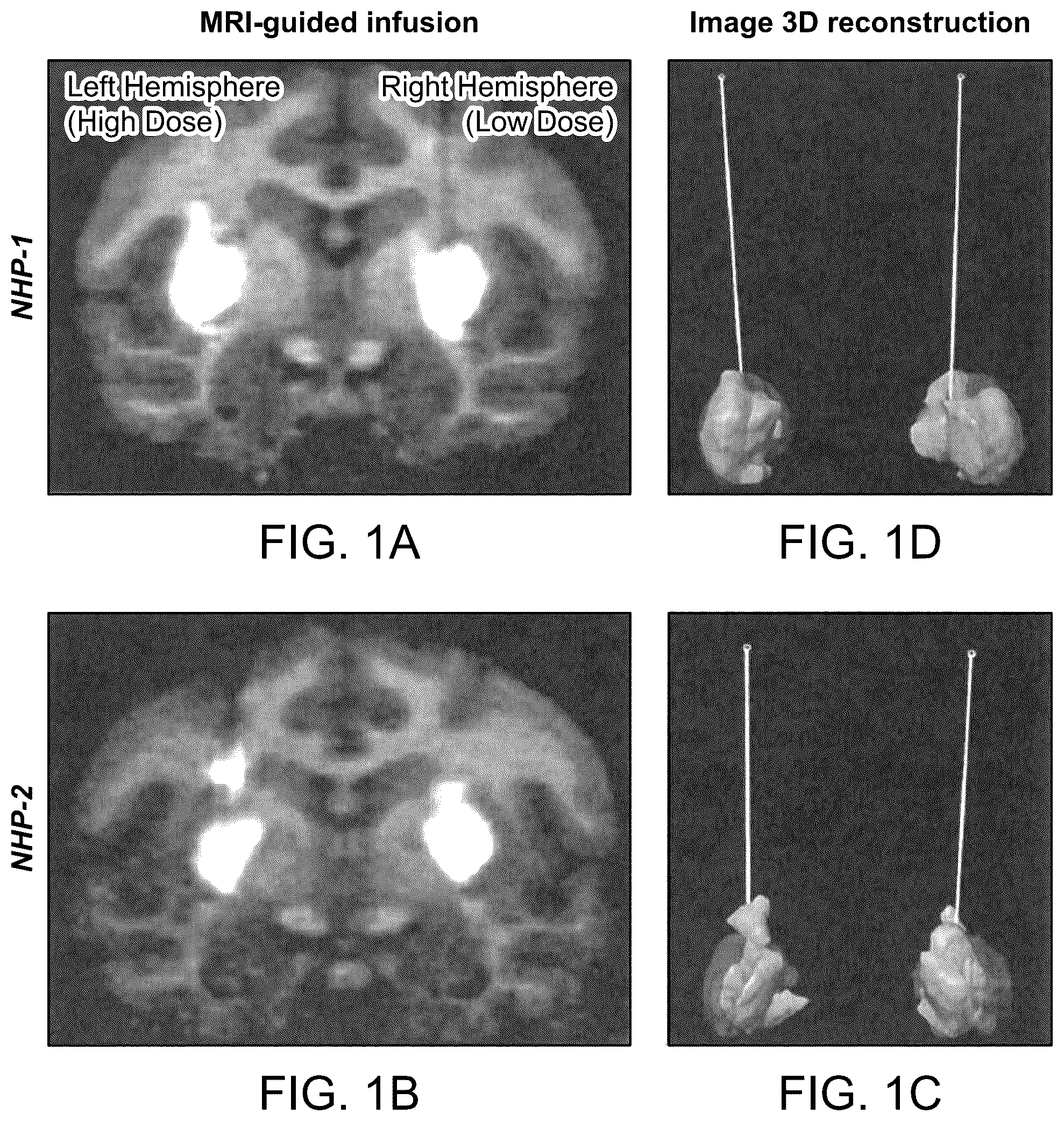 Patent US12551575 — Htt repressors and uses thereof — Figure 1