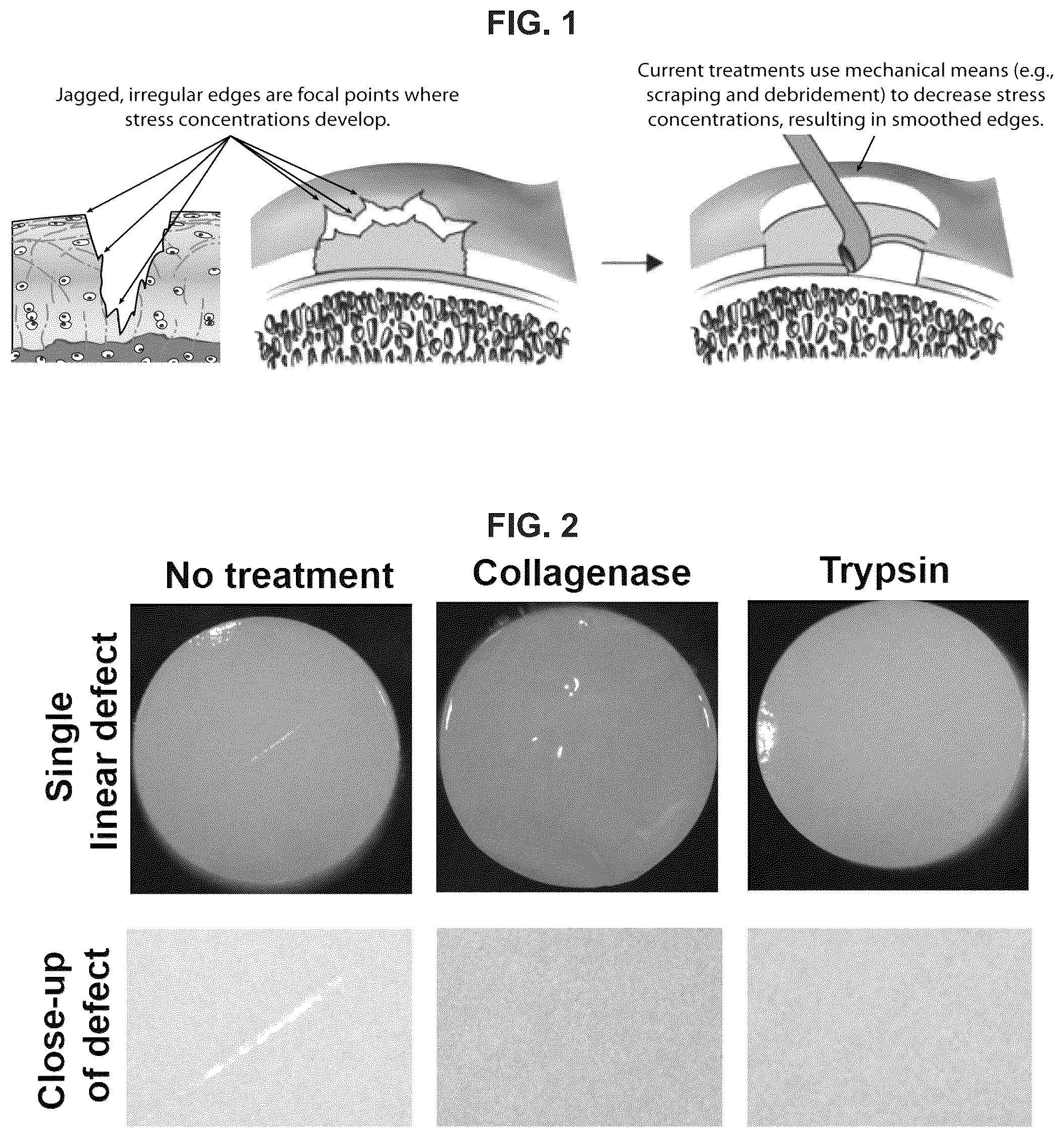 Patent US12551599 — Melt-and-meld approach to repair tissue defects — Figure 1