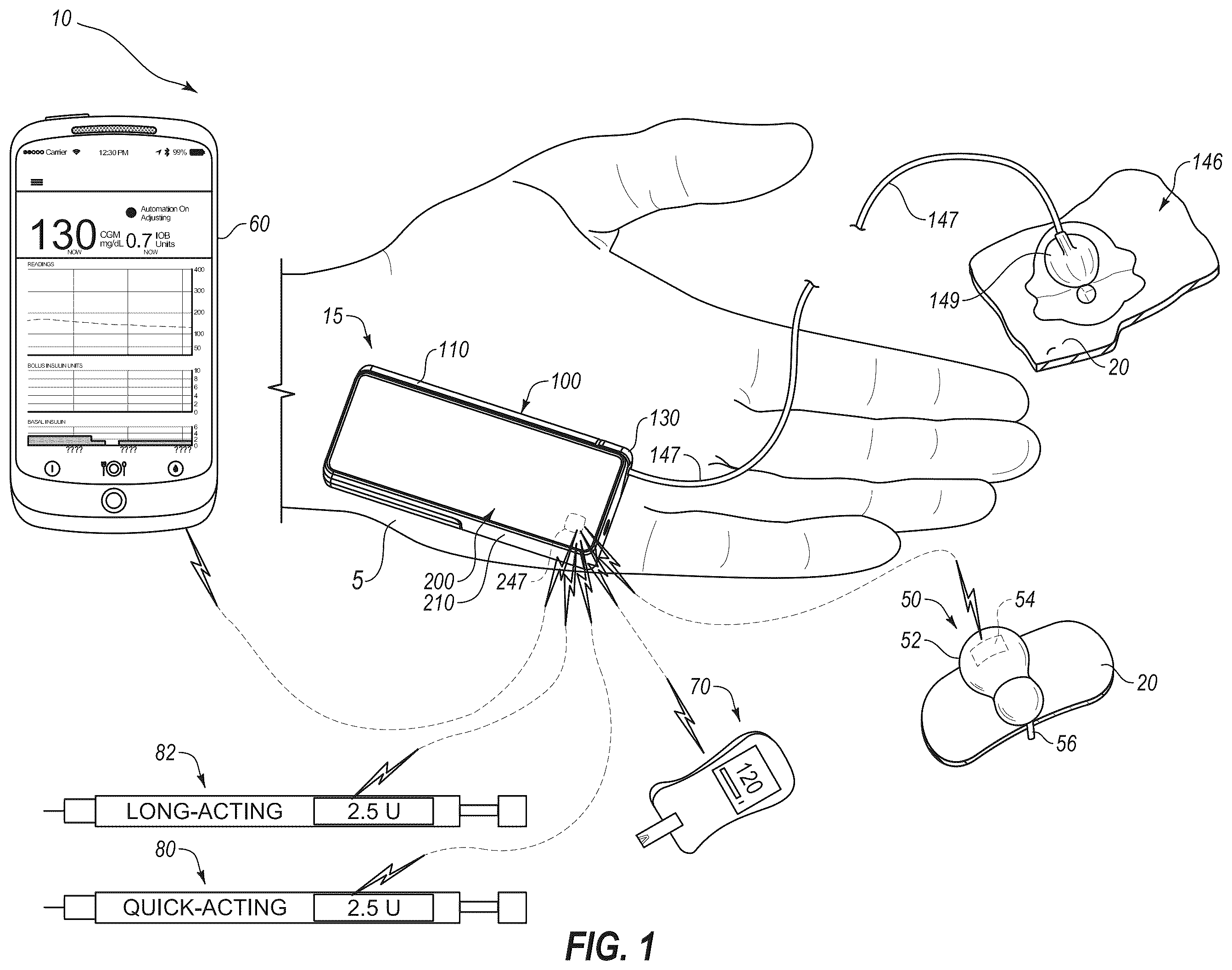 Patent US12551621 — System and method for adjusting insulin delivery — Figure 1
