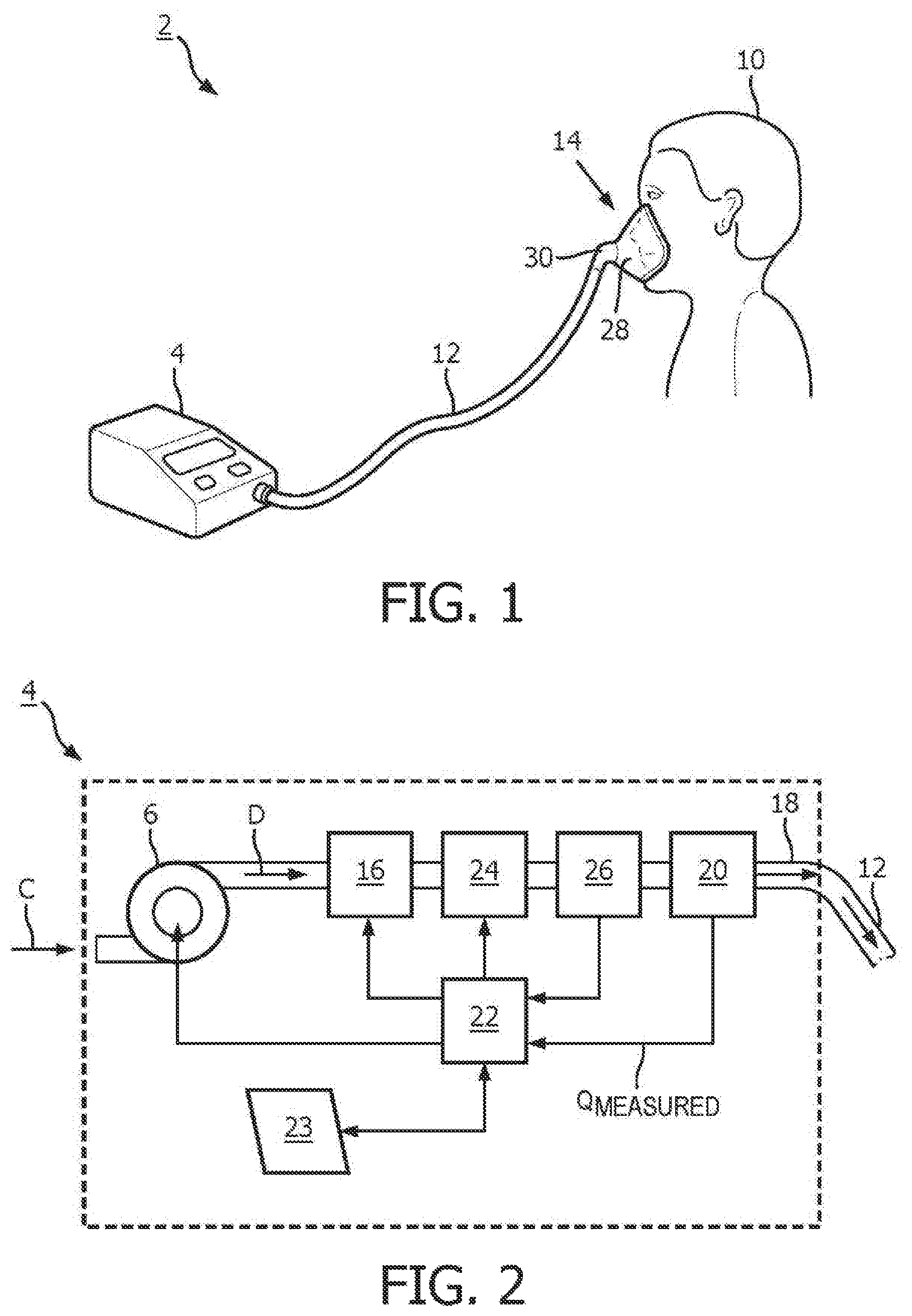 Patent US12551642 — Systems and methods for concurrent airway stabilization and pulmonary stretch receptor activation — Figure 1