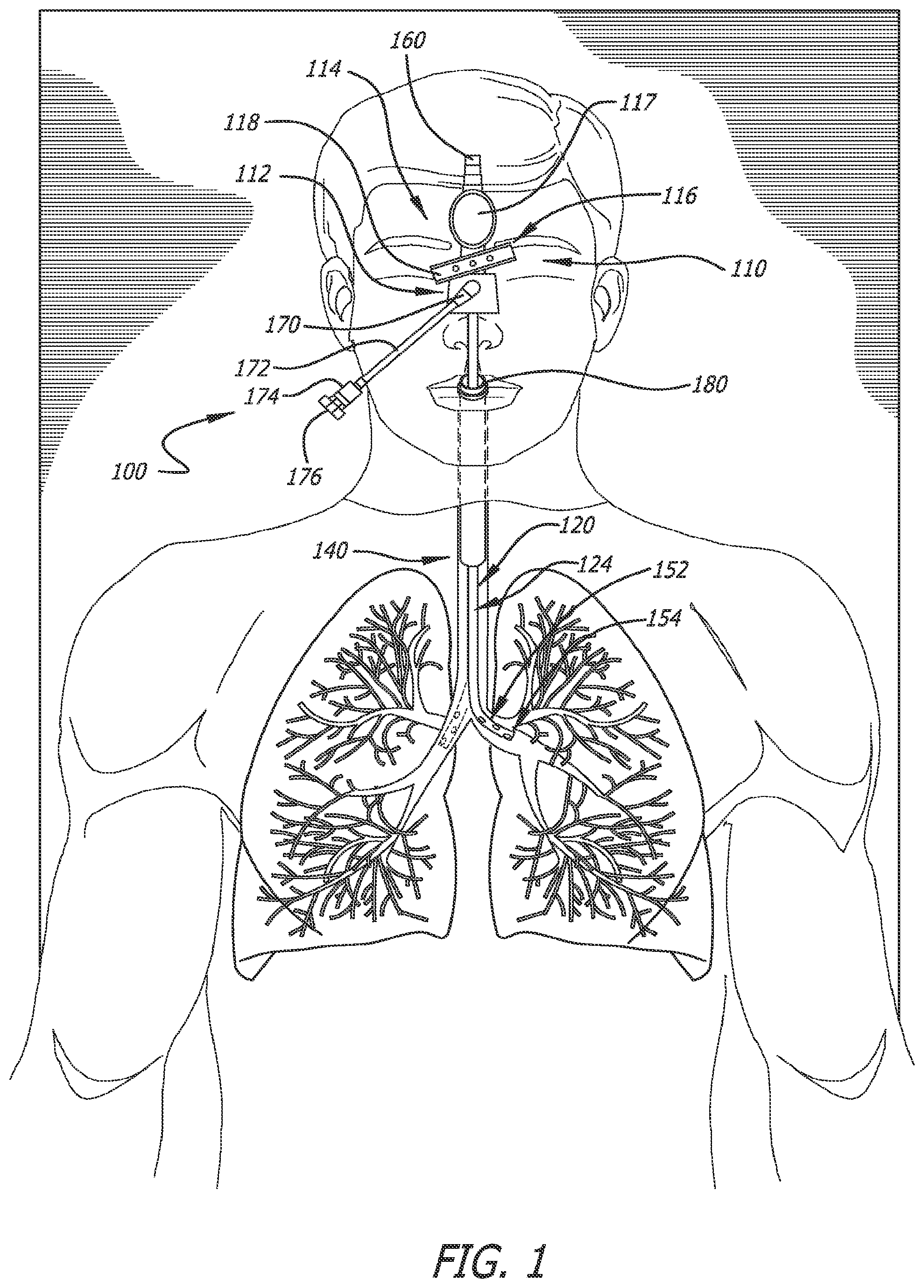 Patent US12551644 — Endobronchial suctioning device and medical suctioning system for intubated patients — Figure 1