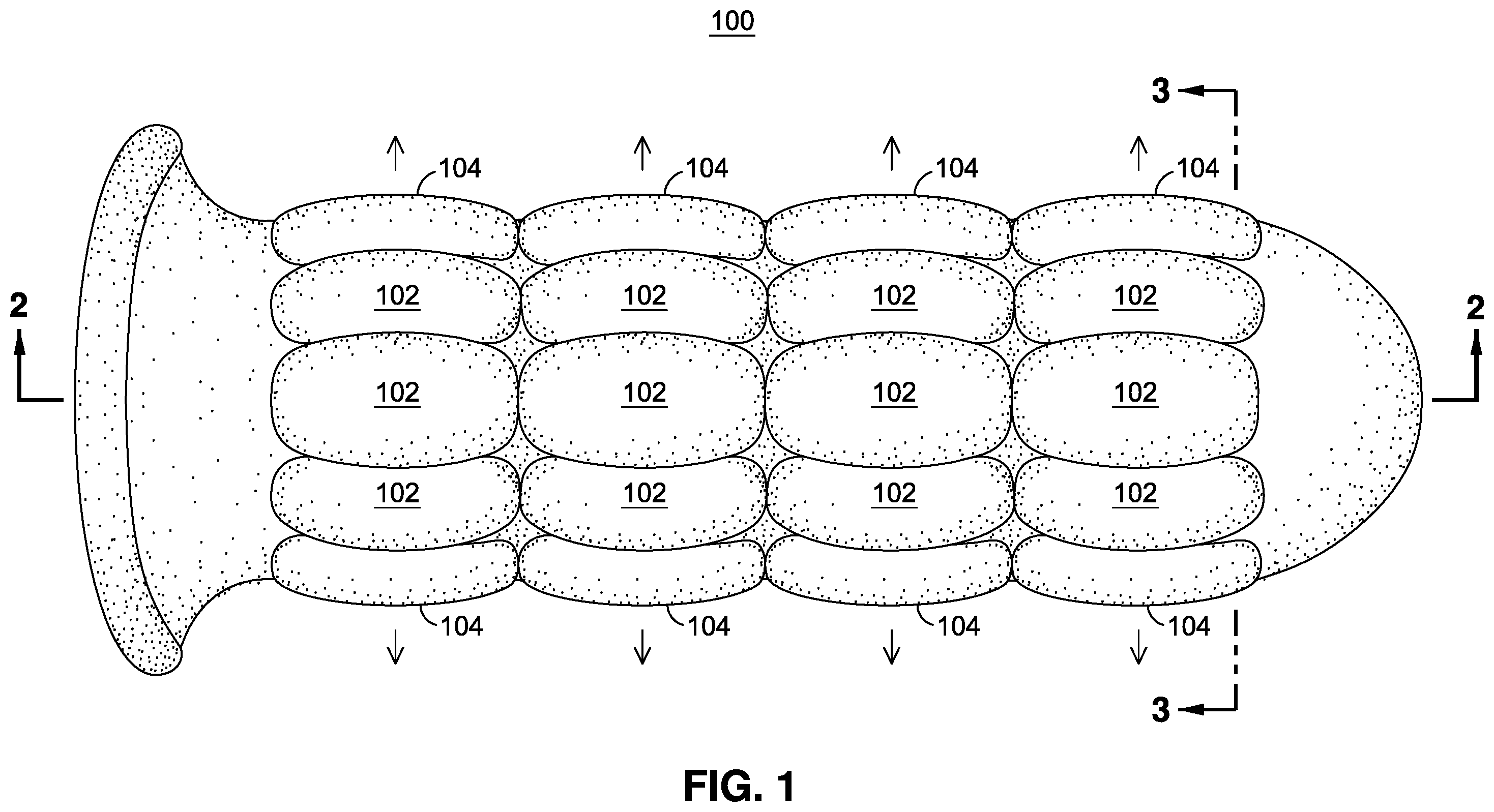 Patent US12551673 Figure 1 – Systems and methods for improved enhanced dilation devices for targeted dilatation diagnostics and therapies