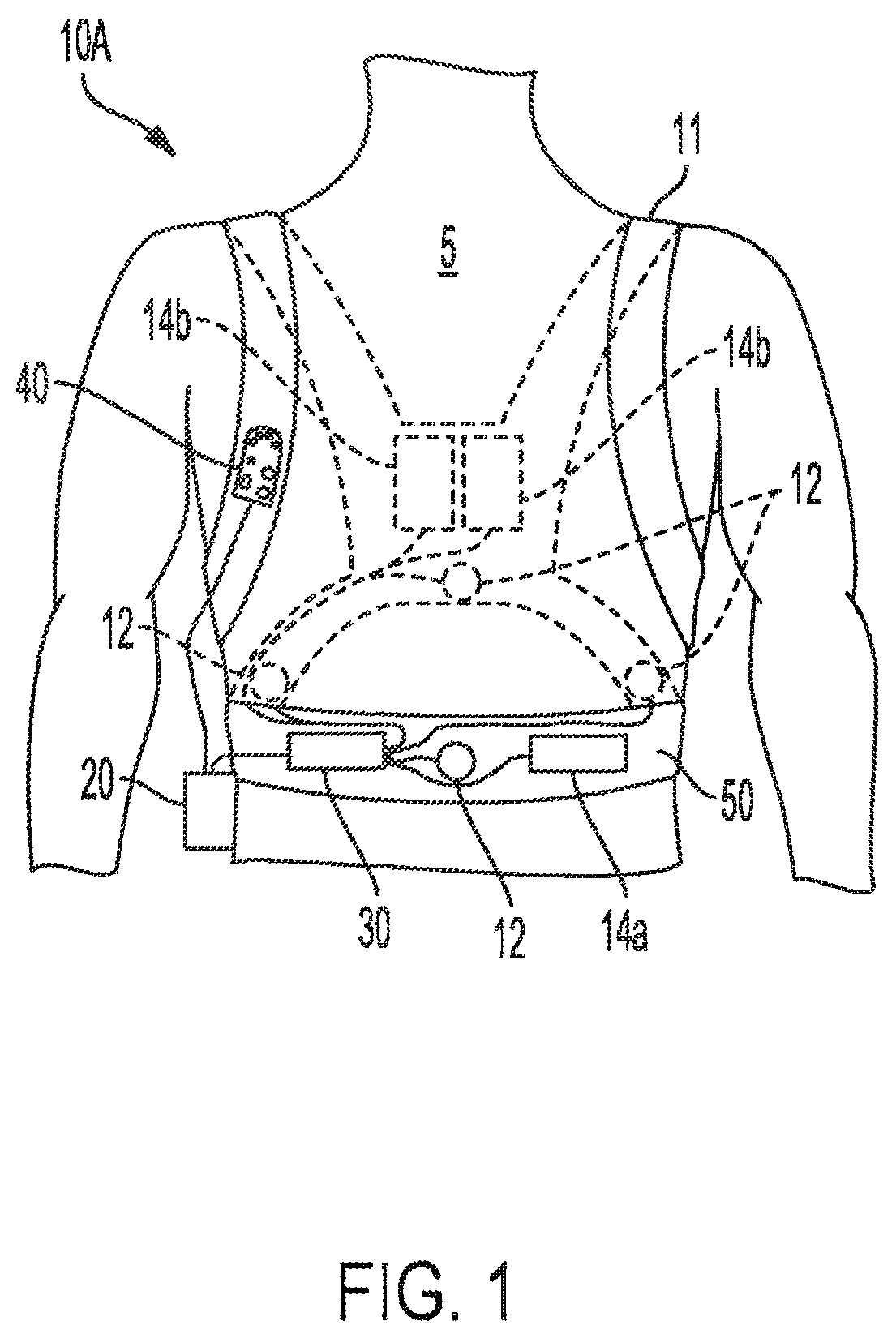Patent US12551693 — Adhesively coupled wearable medical device — Figure 1