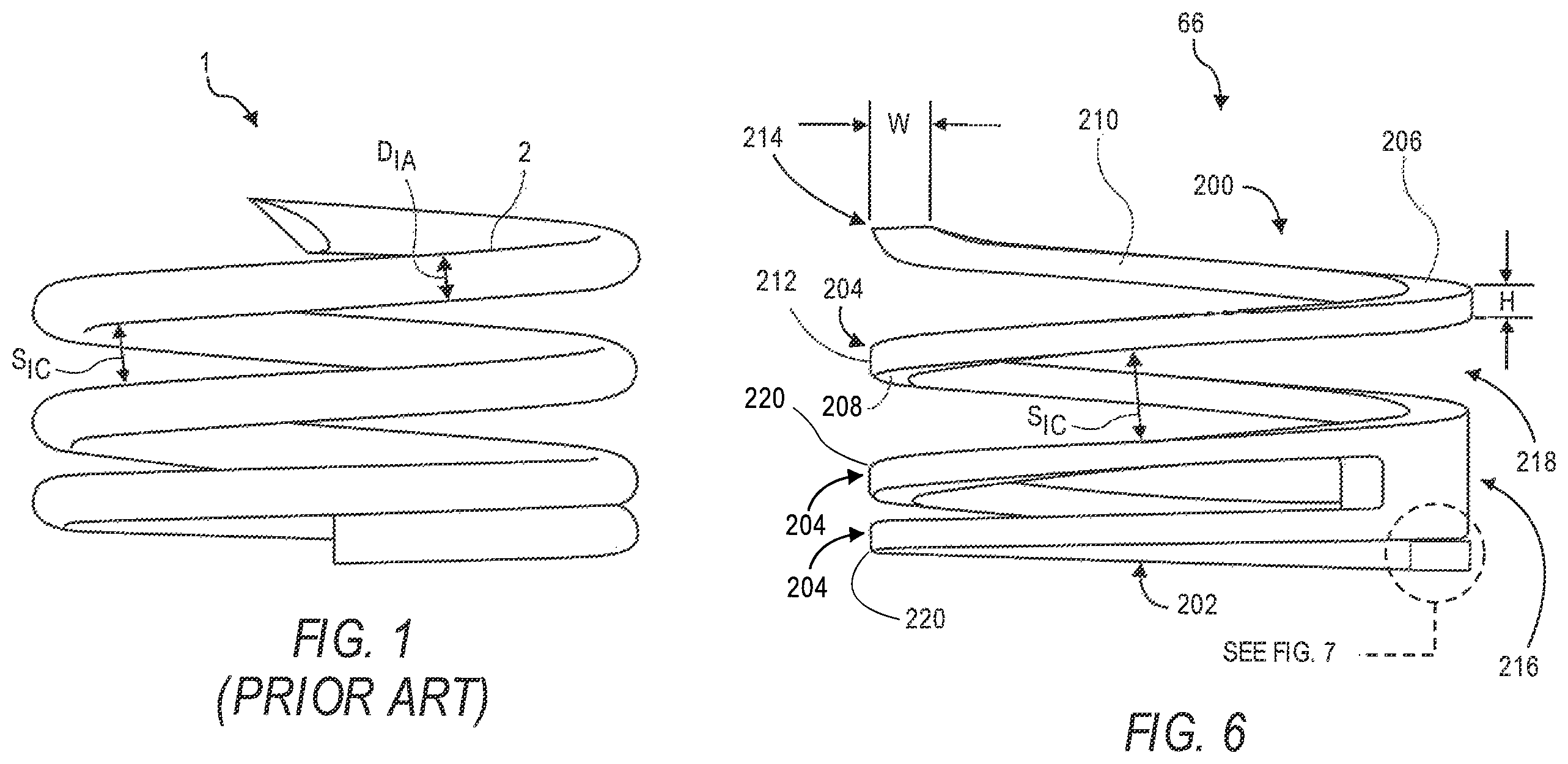 Patent US12551695 — Tube-cut helical fixation anchor for electrotherapy device — Figure 1