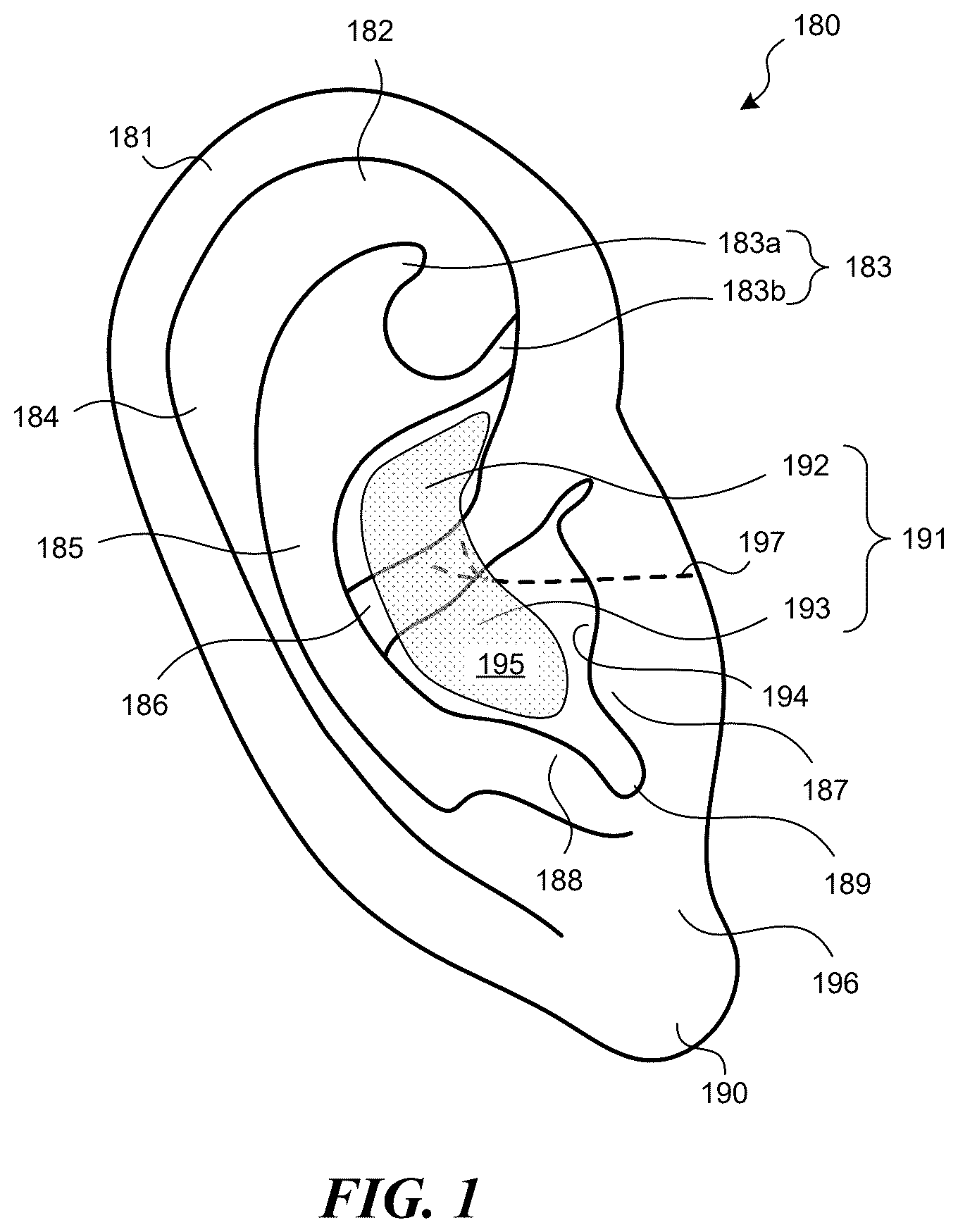 Patent US12551700 — Adjustable auricular nerve stimulation devices, and associated systems and methods — Figure 1