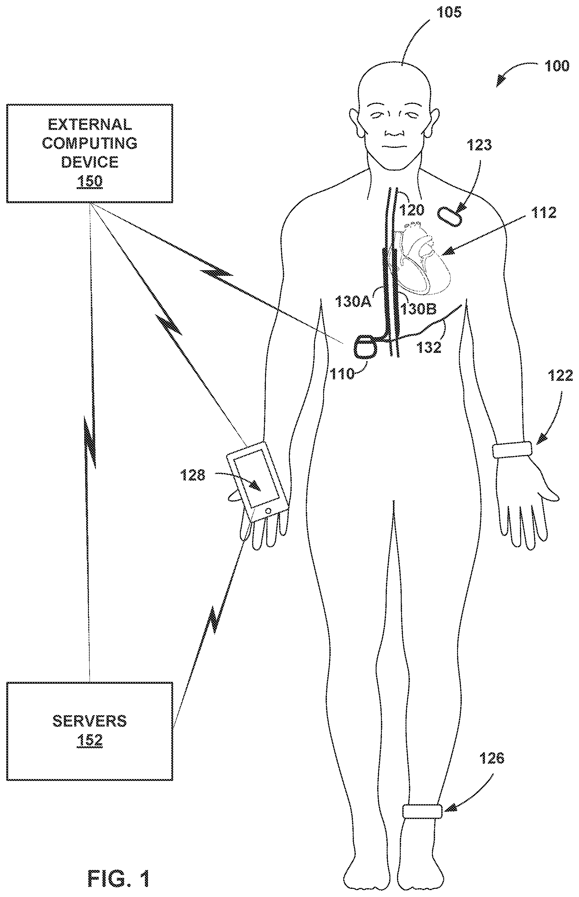 Patent US12551704 — Environment-responsive neurostimulation pain therapy optimization — Figure 1