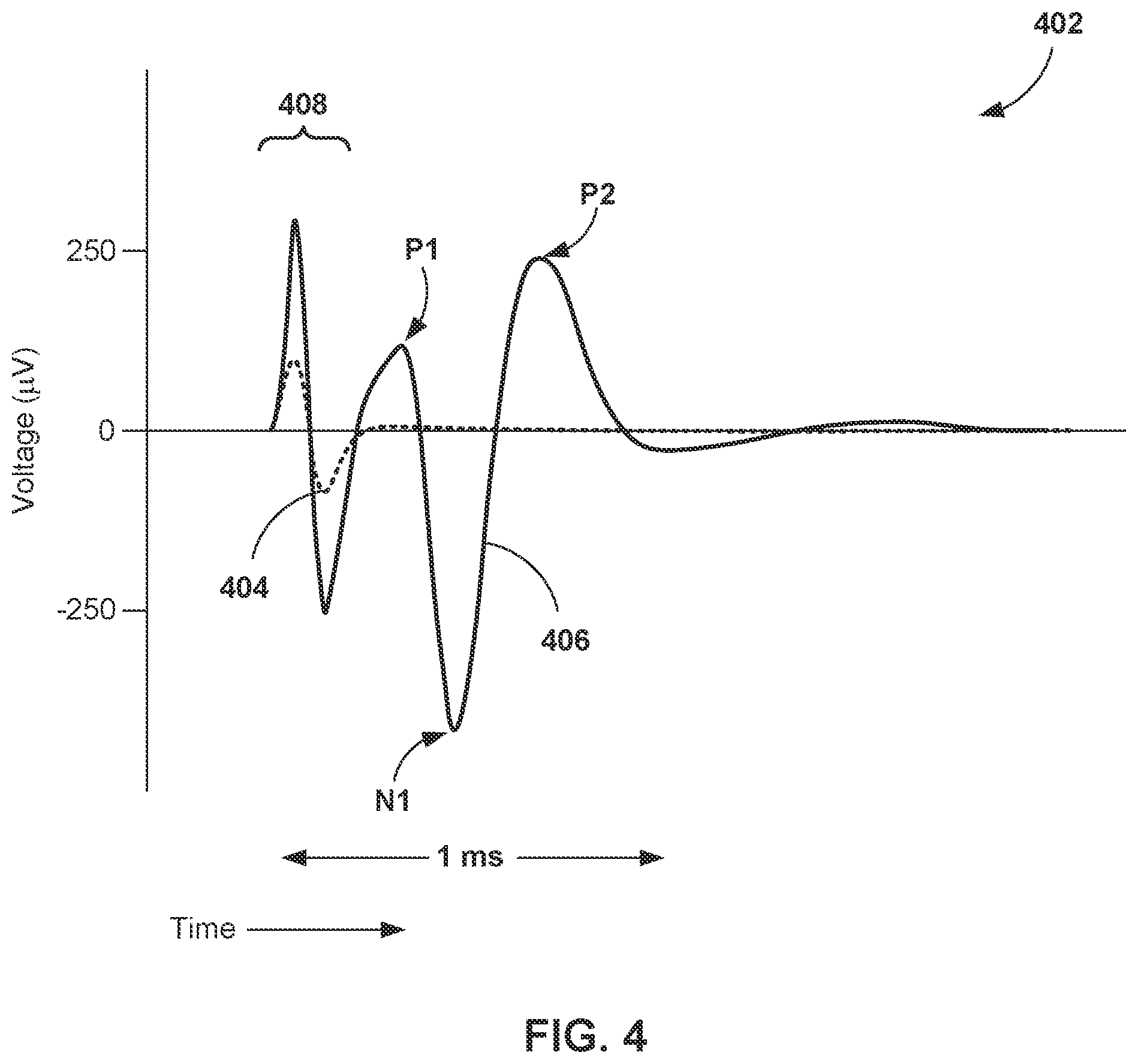 Patent US12551704 Figure 4 – Environment-responsive neurostimulation pain therapy optimization