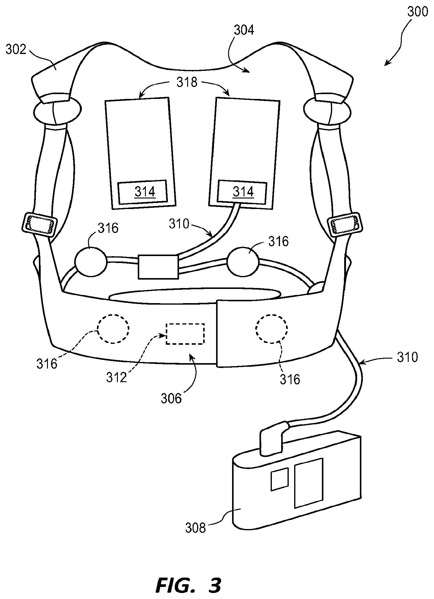 Patent US12551713 Figure 3 – Positive system alerts