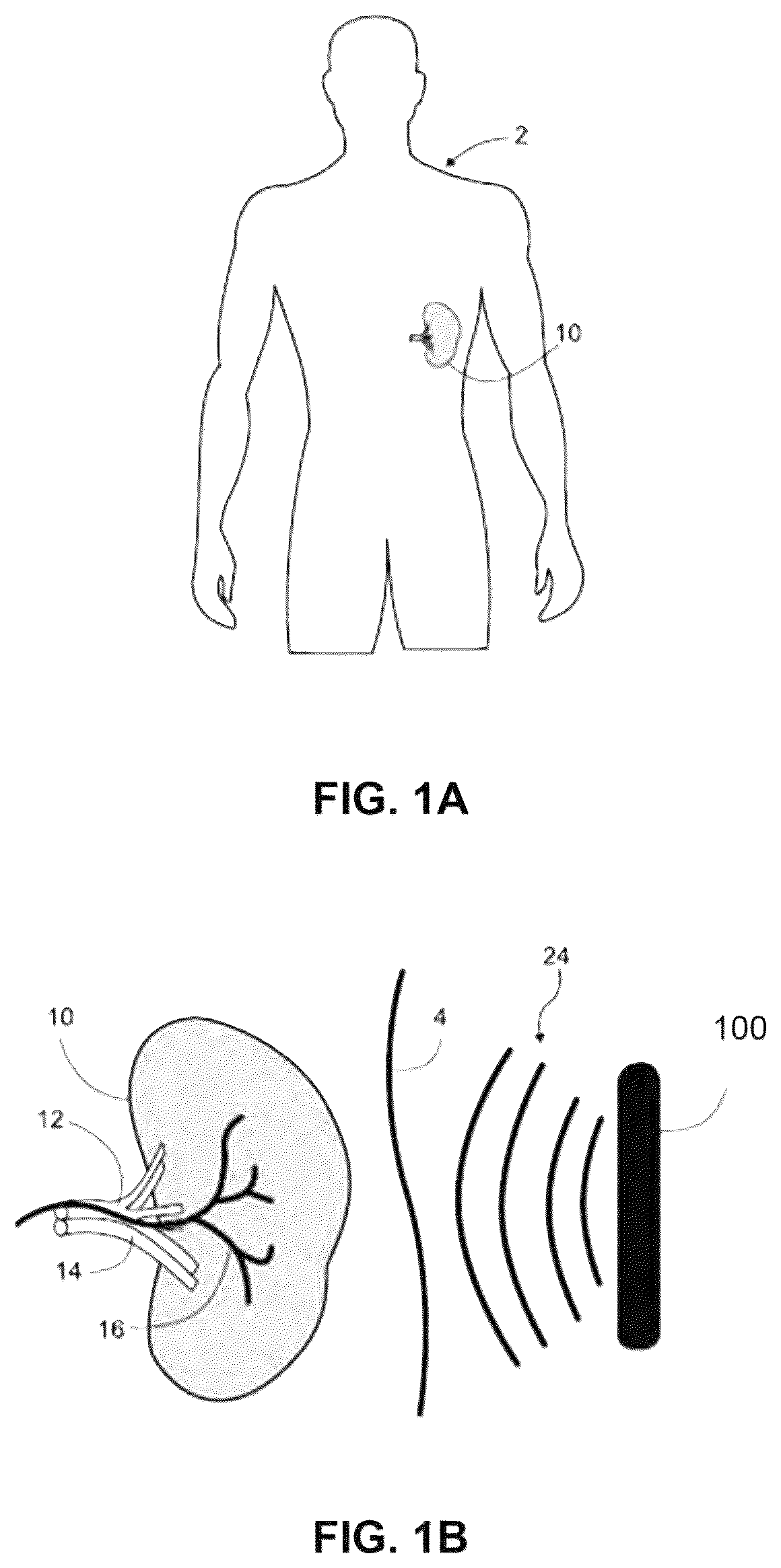 Patent US12551730 — Systems and methods for ultrasound neuromodulation of desired anatomical targets — Figure 1