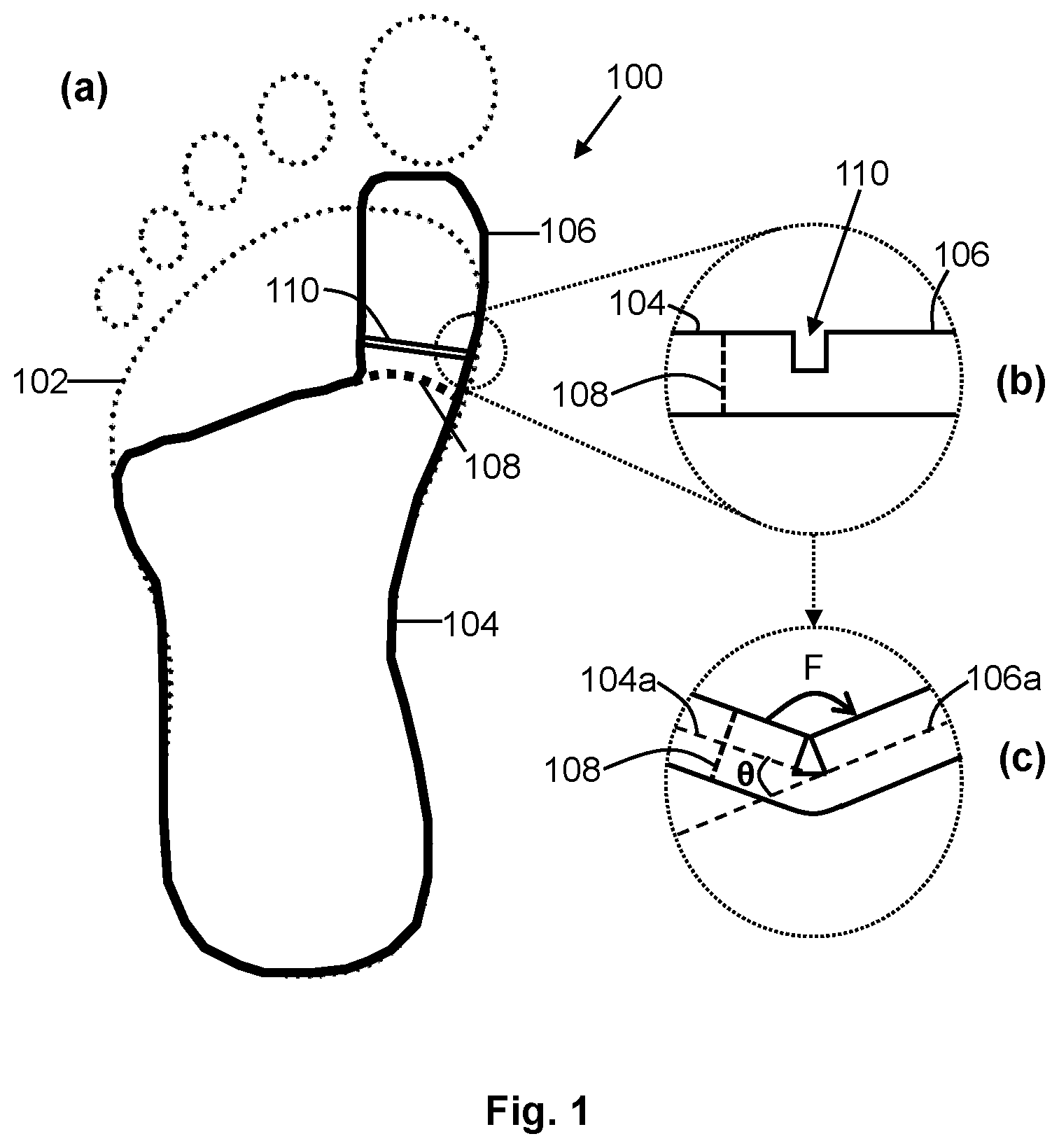 Patent US12552120 — Personalizing foot supports — Figure 1