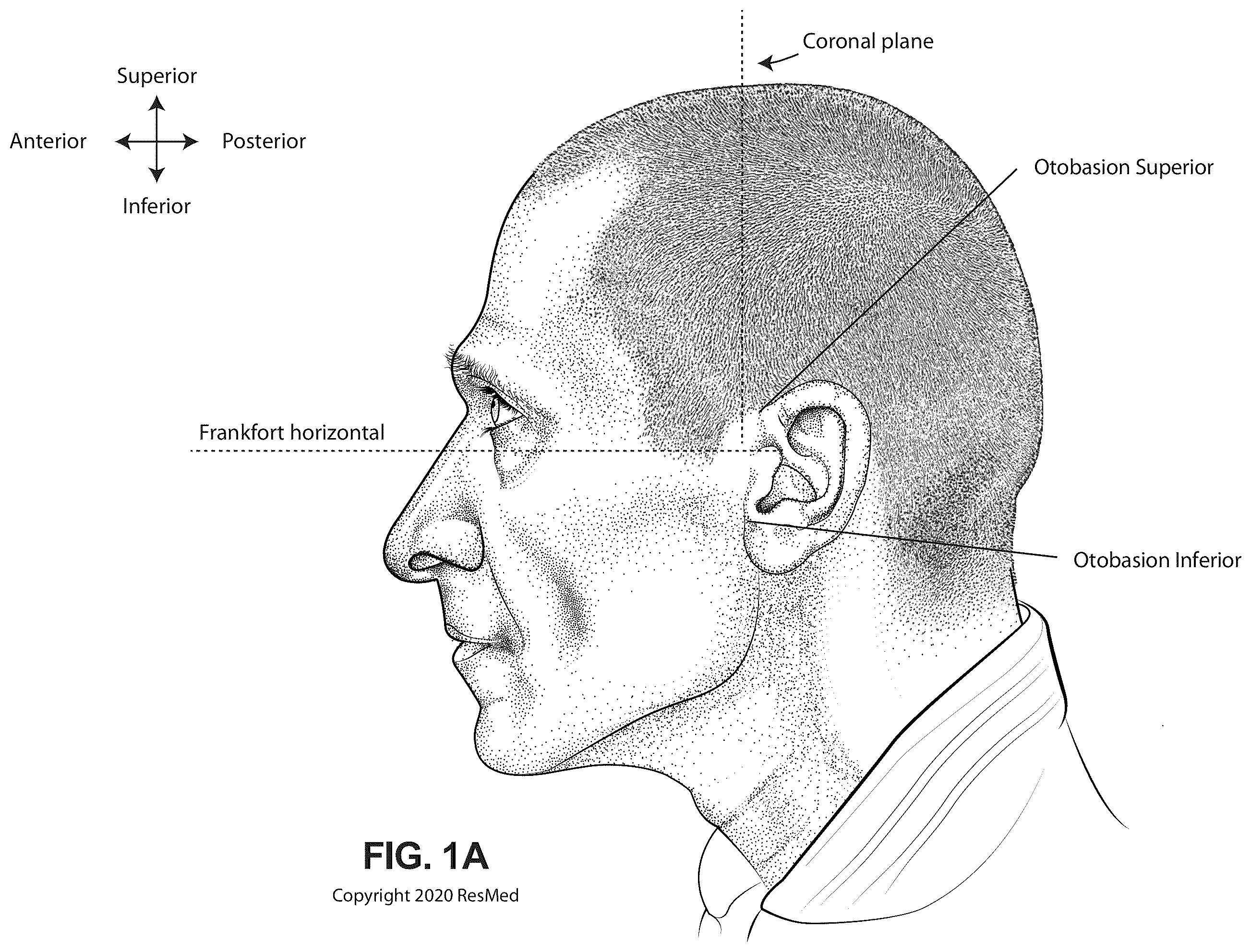 Patent US12564236 — Positioning and stabilising structure and system incorporating same — Figure 1