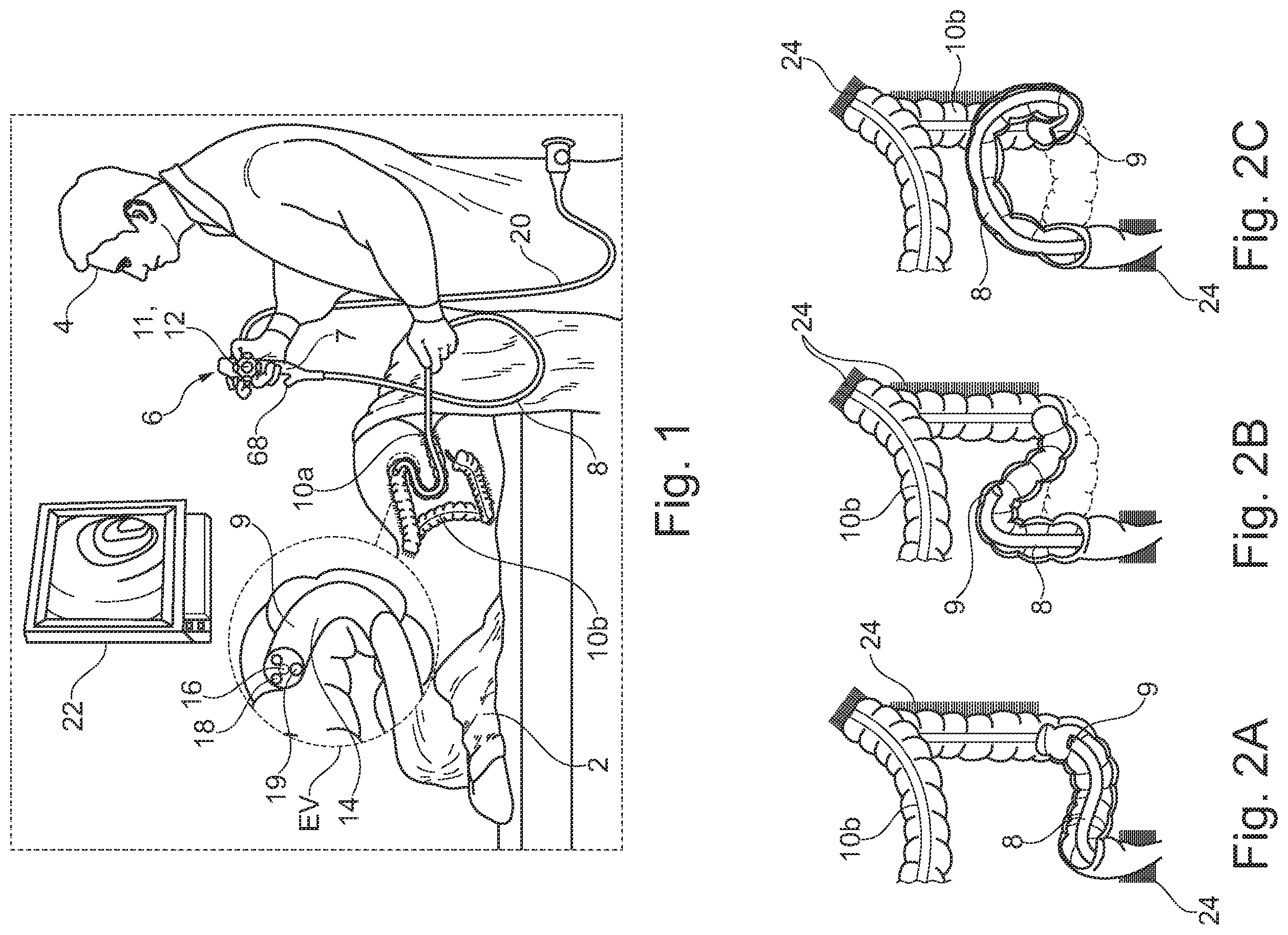 Patent US12564314 — Endoscope with variable stiffness — Figure 1