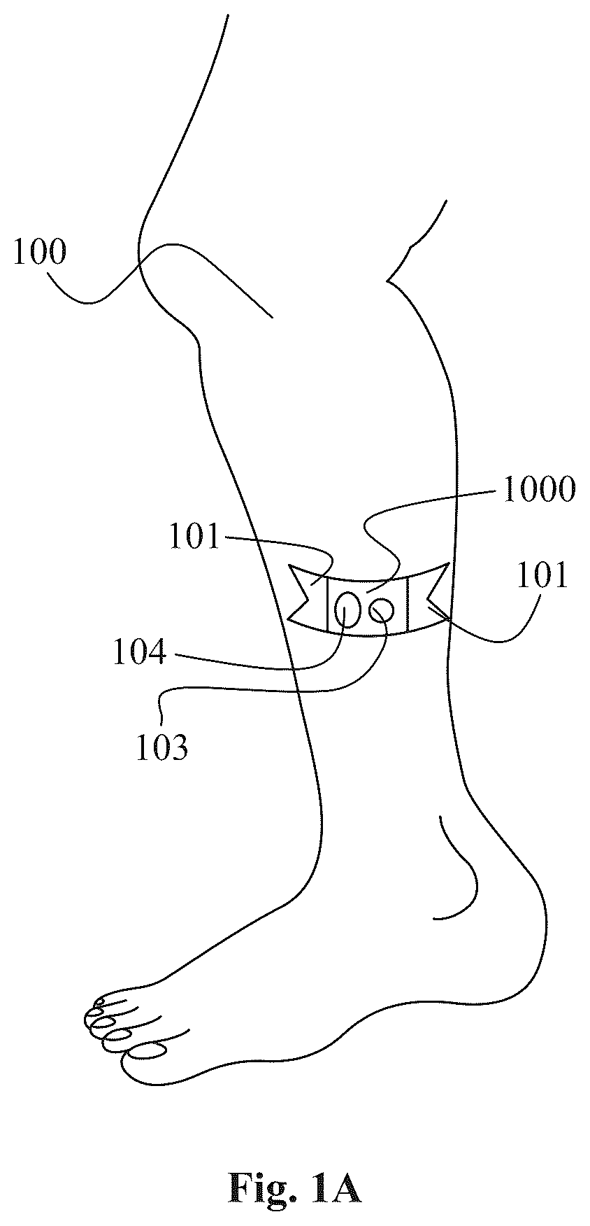 Patent US12564336 — Remote controlled physical activity monitoring — Figure 1
