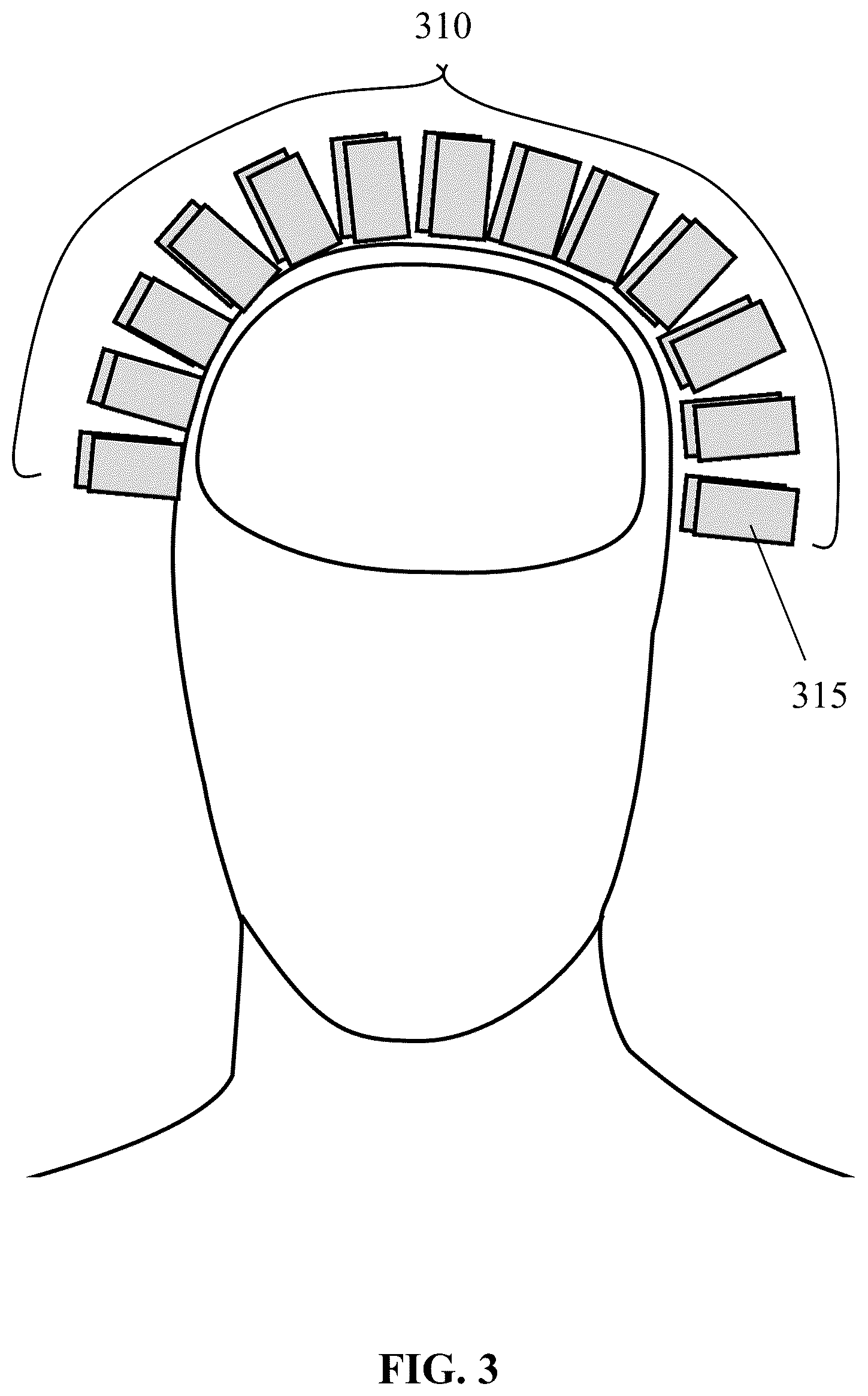 Patent US12564346 Figure 3 – Unshielded pulsed pump magnetometers for biomagnetic measurements