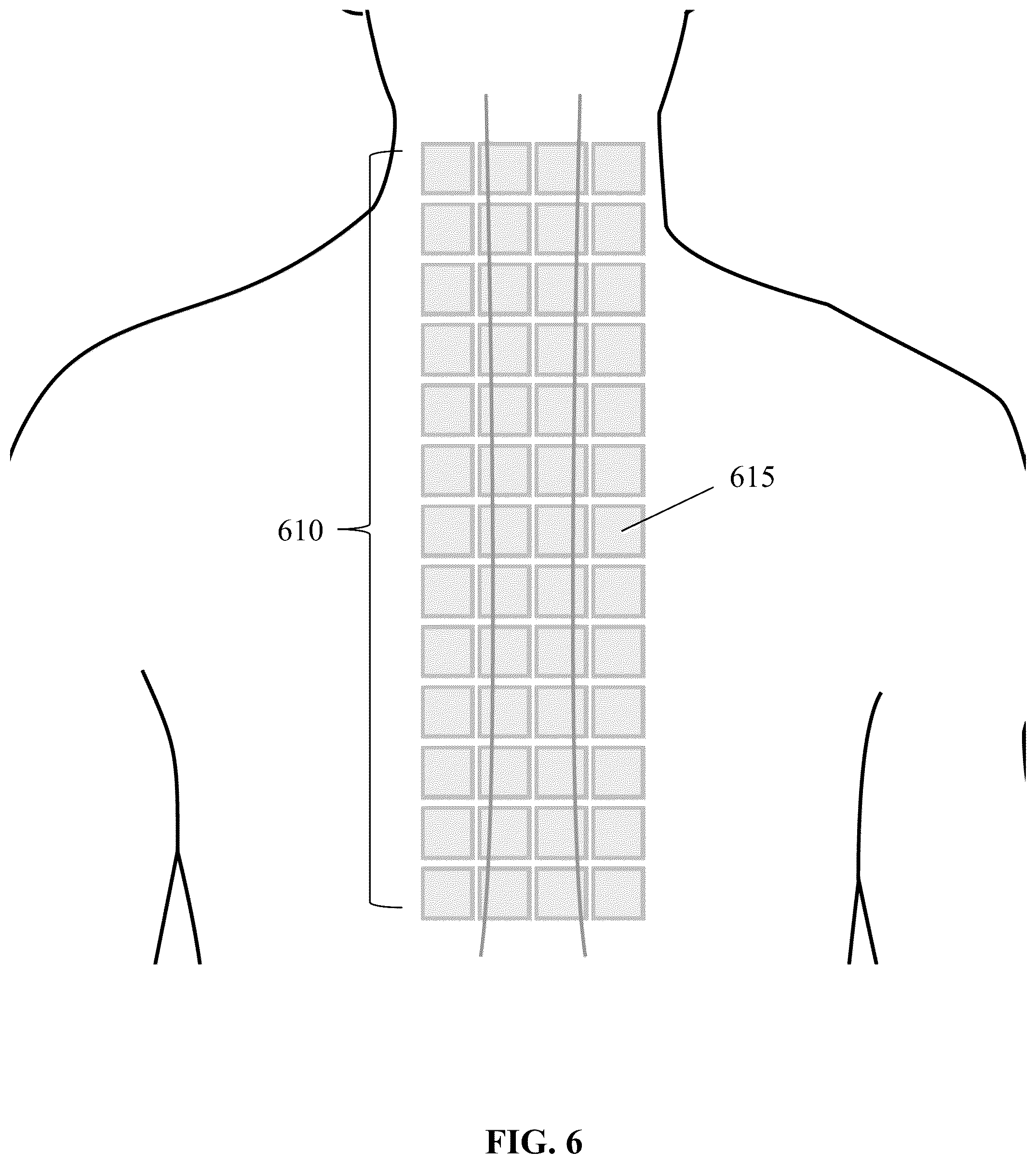Patent US12564346 Figure 6 – Unshielded pulsed pump magnetometers for biomagnetic measurements