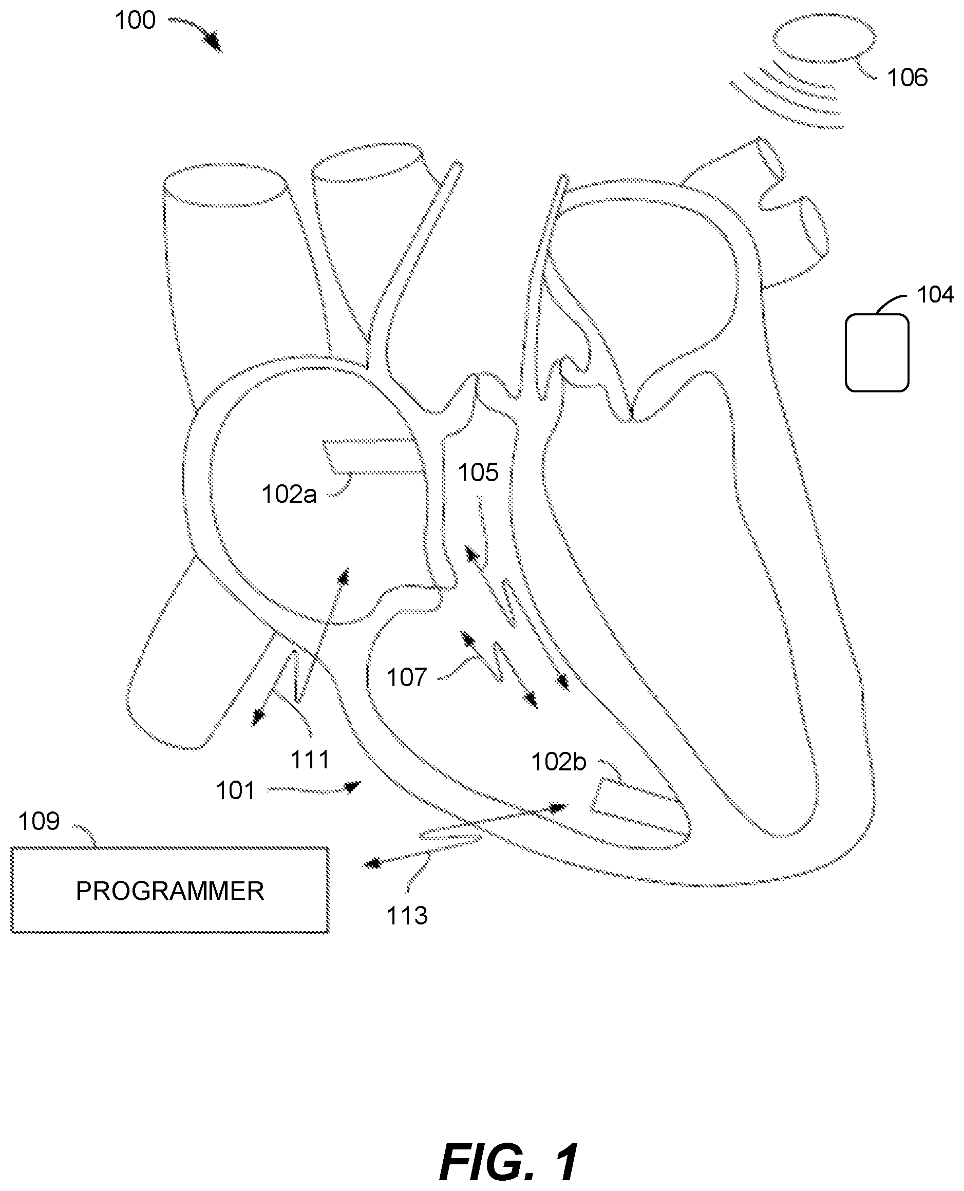 Patent US12564358 — Systems and methods for remote programming of, and other follow-up capabilities with, leadless pacemakers — Figure 1