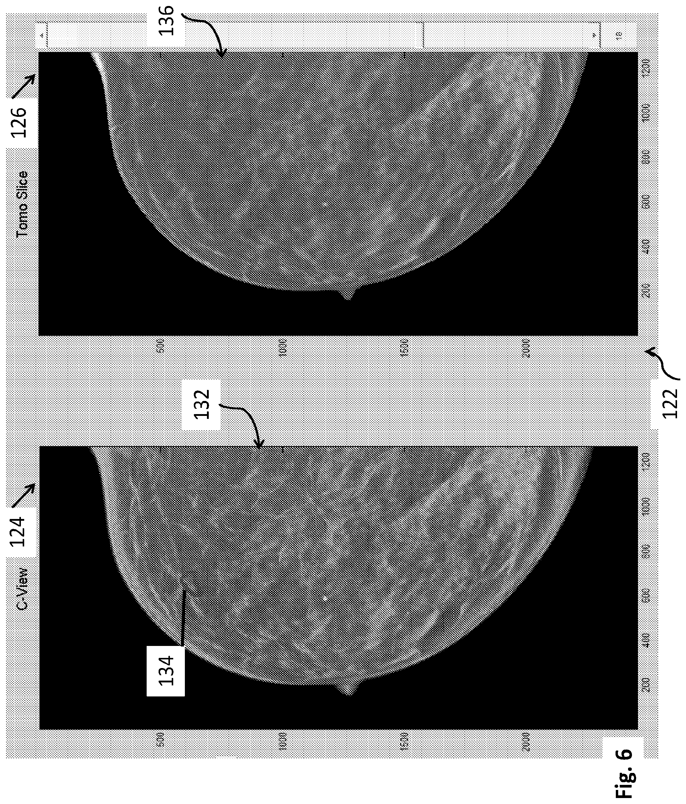 Patent US12564365 Figure 6 – System and method for generating and displaying tomosynthesis image slabs