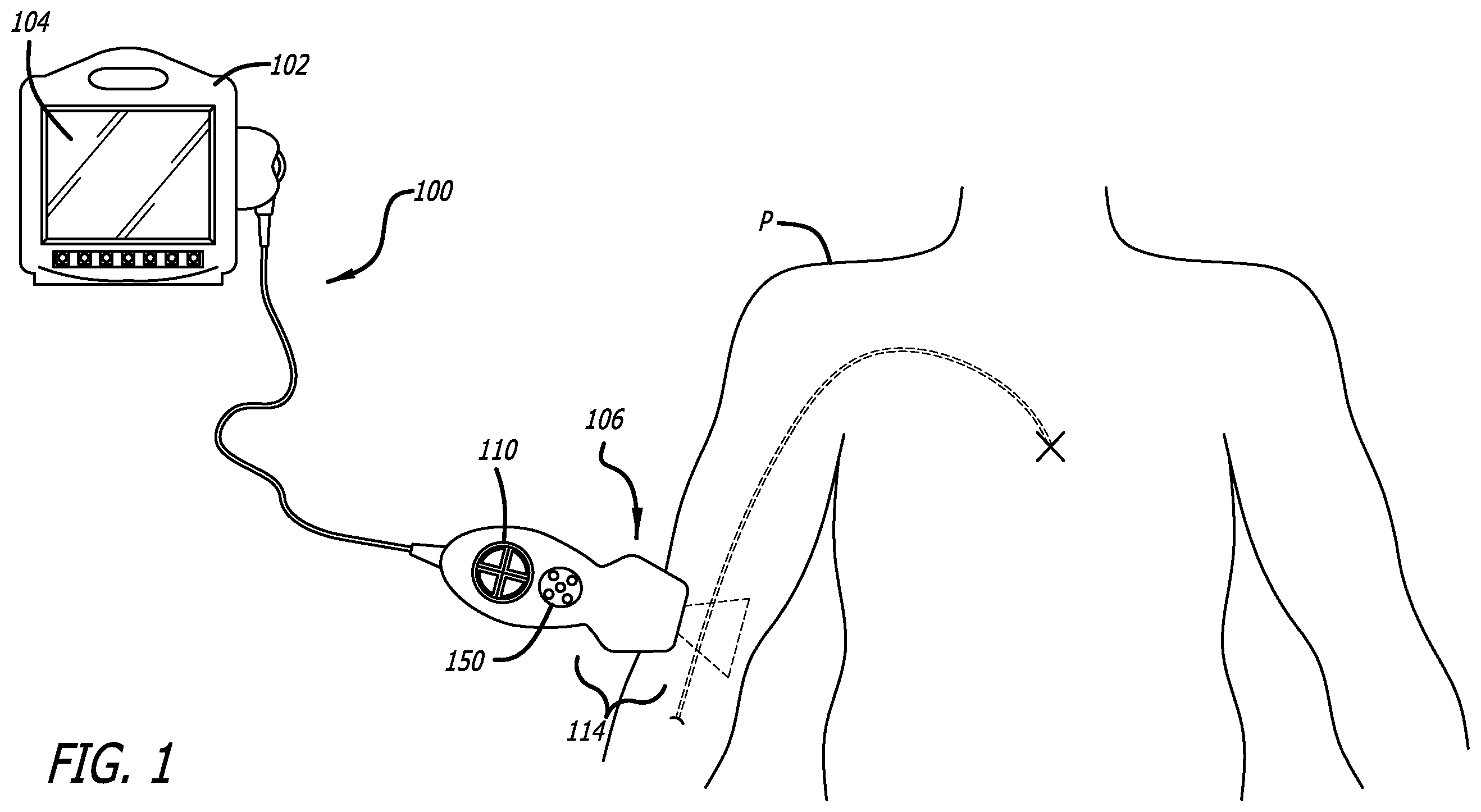 Patent US12564373 — Spatially aware medical device configured for performance of insertion pathway approximation — Figure 1