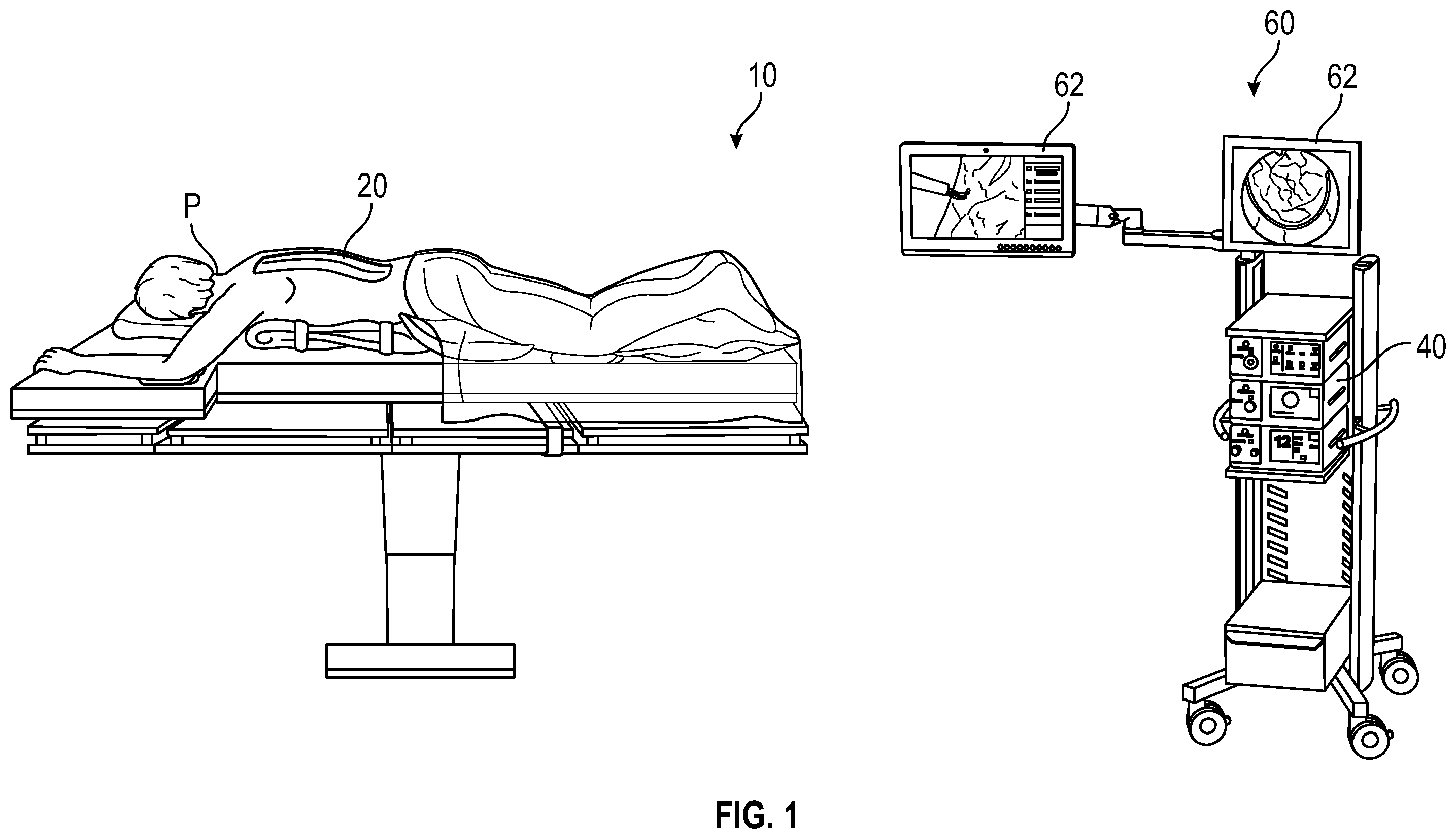 Patent US12564374 — Spinal cerebral artery rupture detector — Figure 1