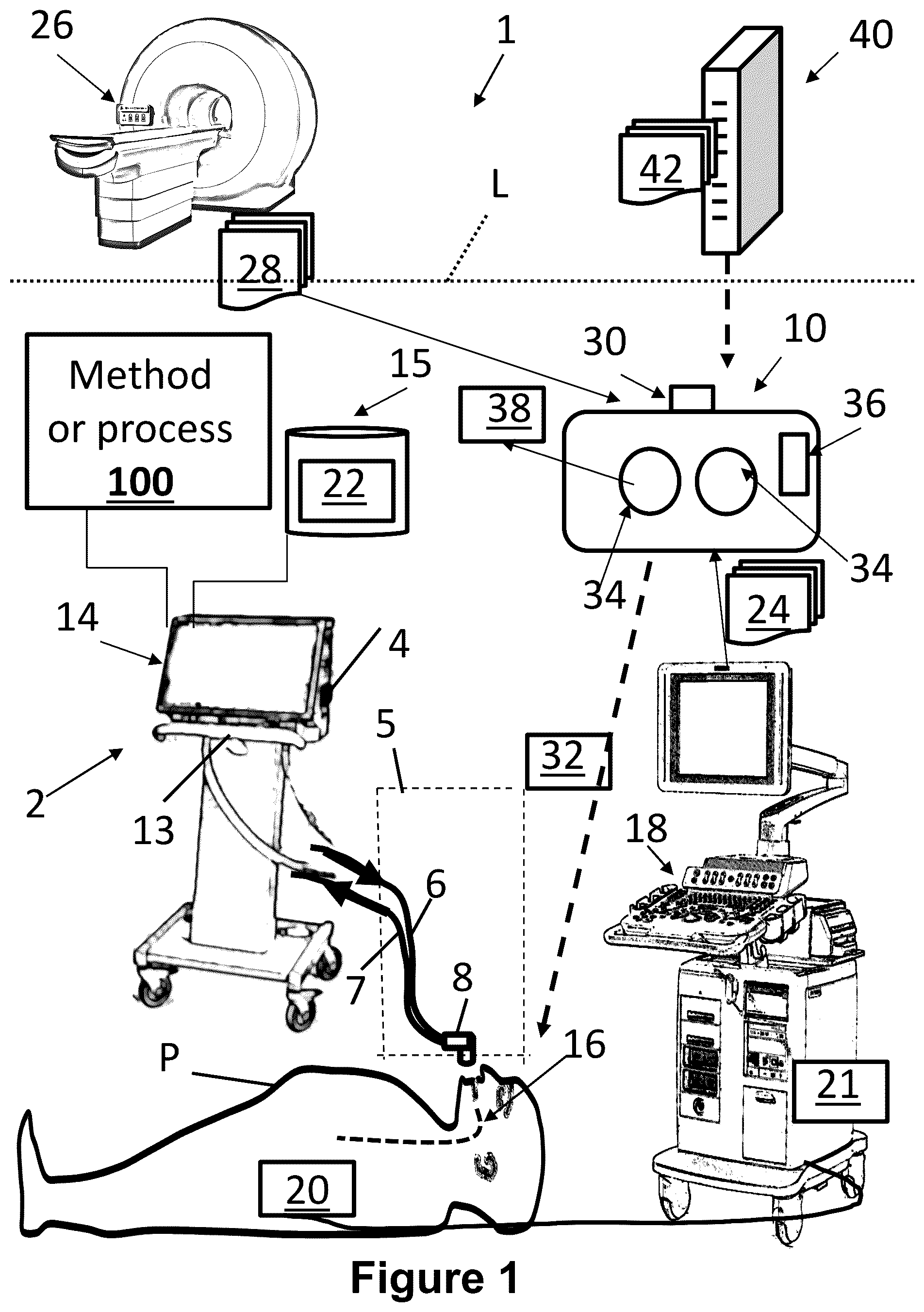 Patent US12564377 — Augmented reality for ultrasound exams at the point-of-care in combination with mechanical ventilation — Figure 1