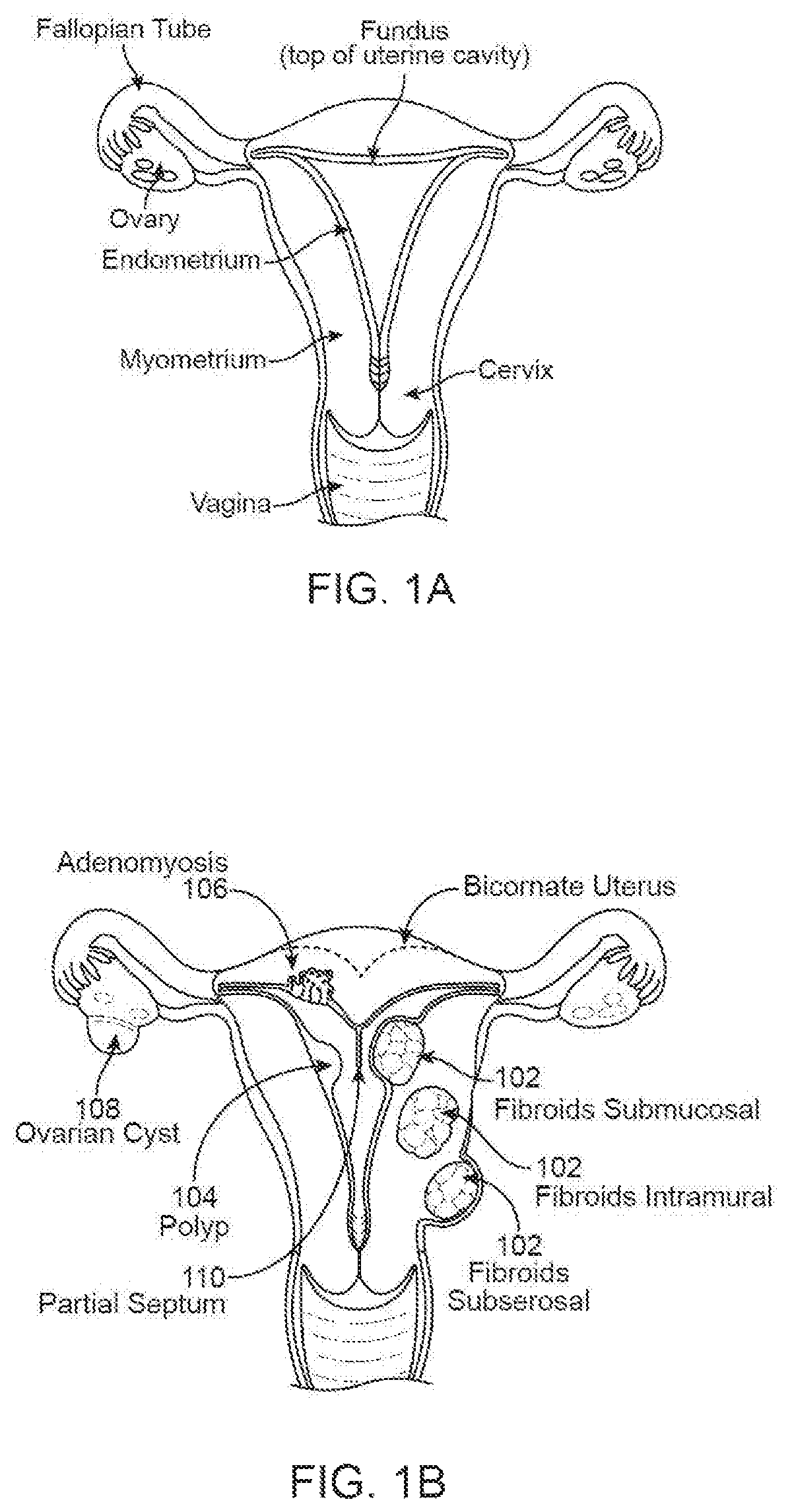 Patent US12564383 — Enhanced ultrasound imaging apparatus and associated methods of work flow — Figure 1