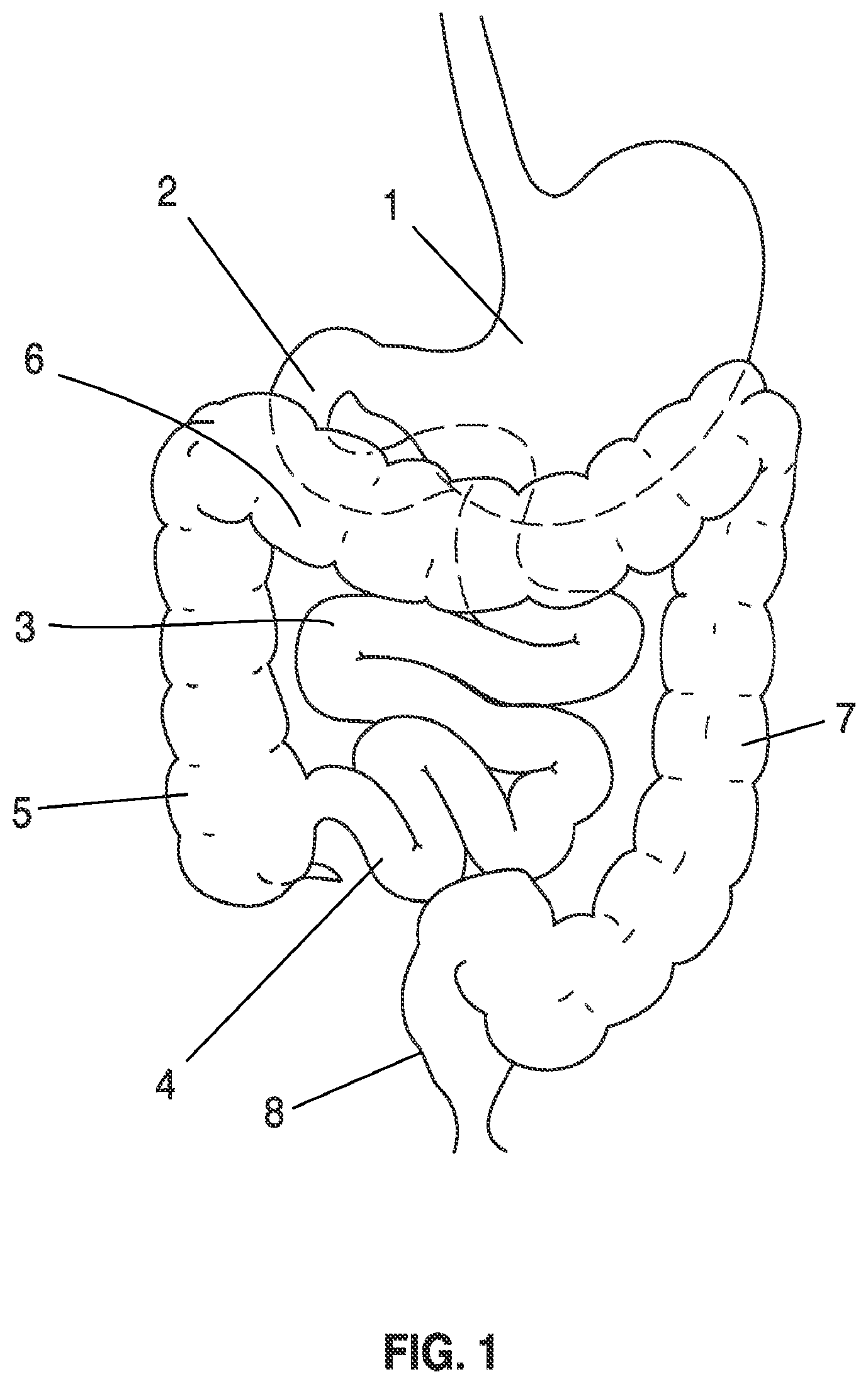 Patent US12564389 Figure 1 – Devices and methods for sampling gastrointestinal fluids and assessing gastrointestinal function