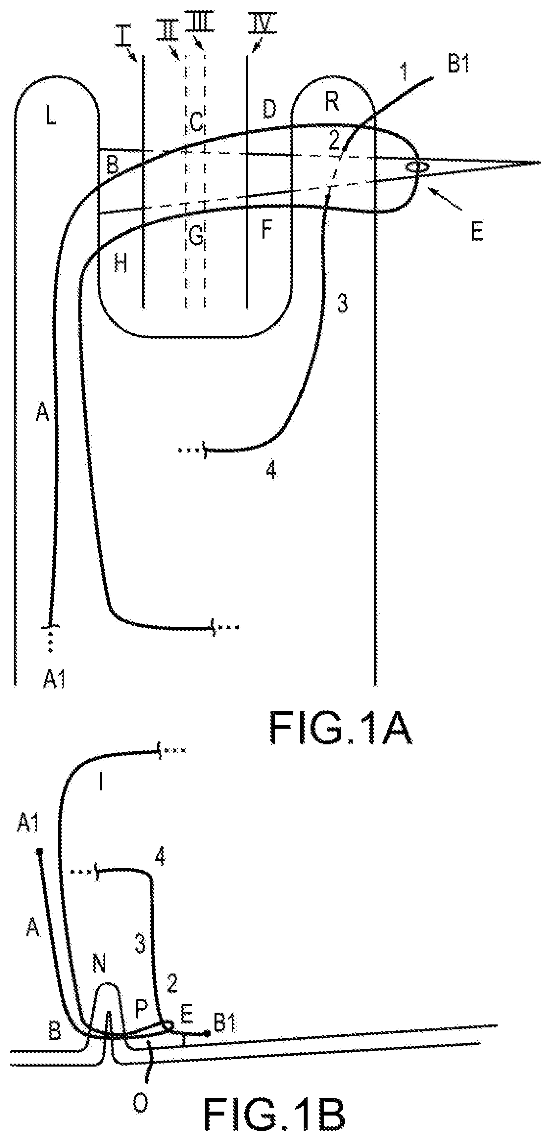 Patent US12564397 — Surgical device for complex suturing fibrous tissues — Figure 1