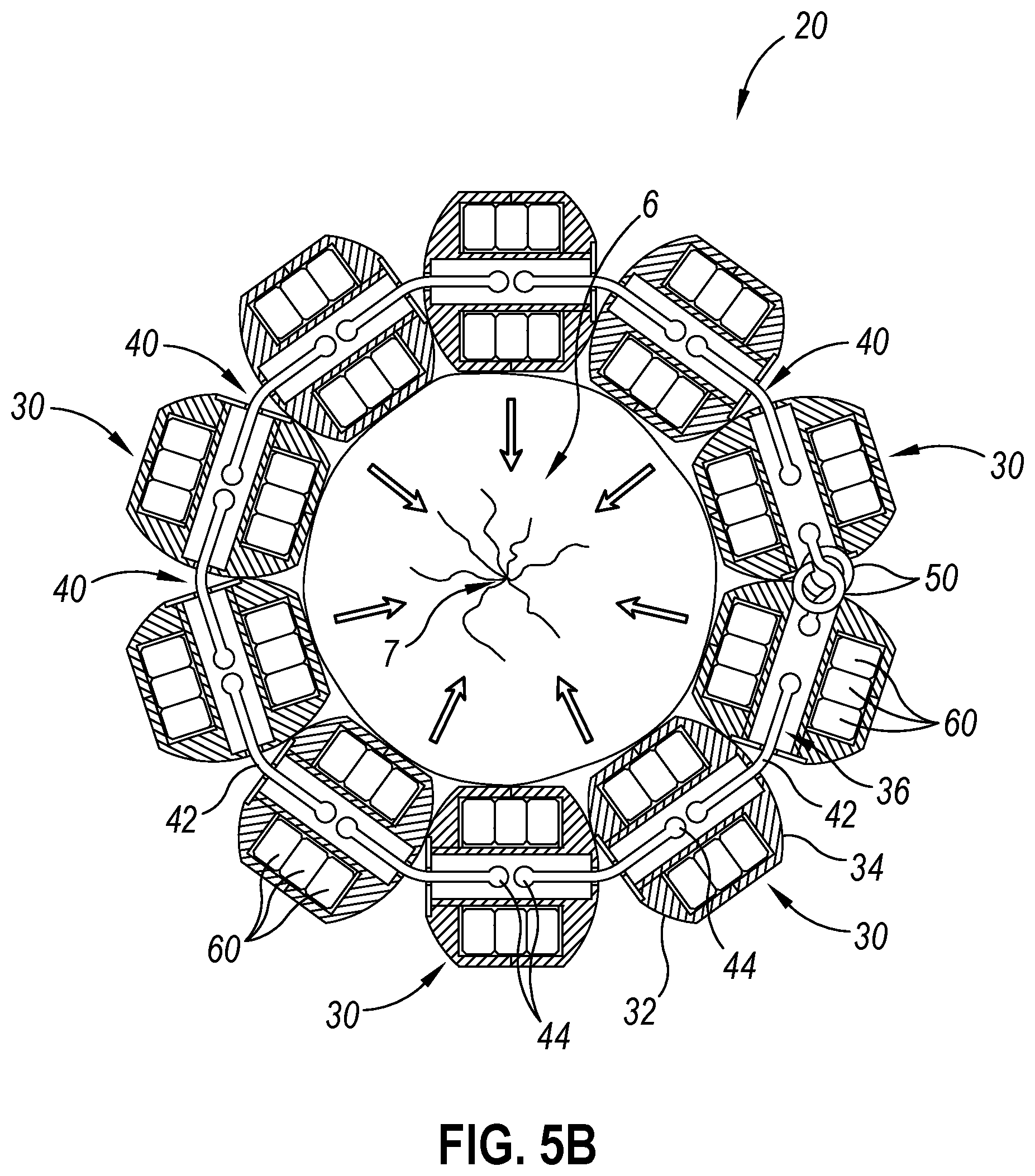 Patent US12564406 Figure 6 – Implantable sphincter assistance device with bimodal circumferential restriction force threshold