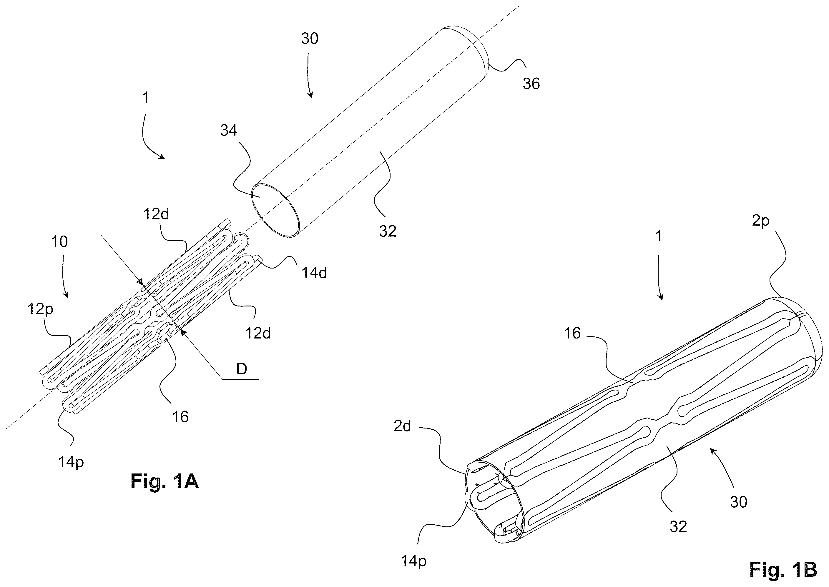 Patent US12564407 — Reversible occlusion device, system and method — Figure 1