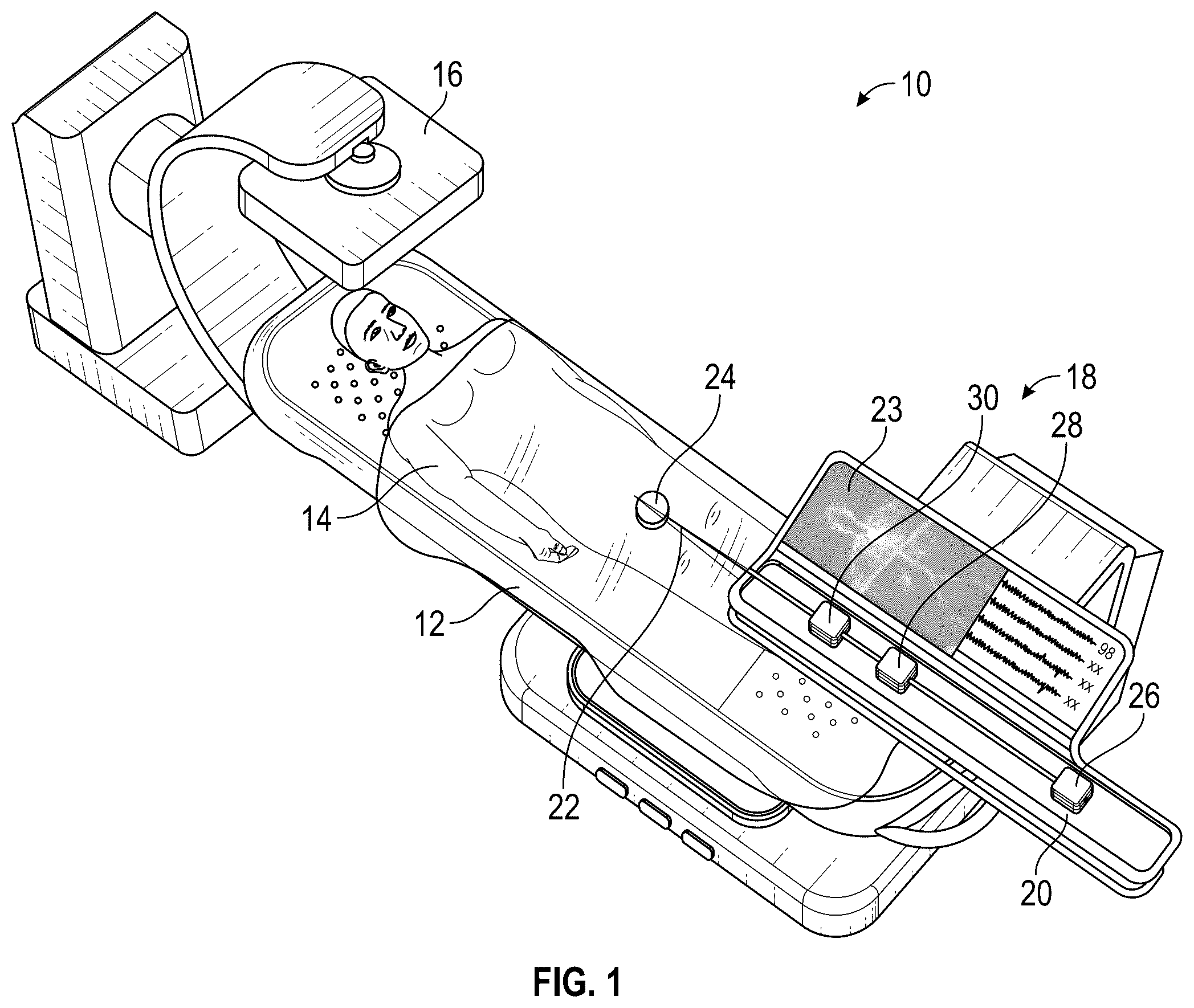 Patent US12564414 Figure 1 – Method of supra-aortic access for a neurovascular procedure