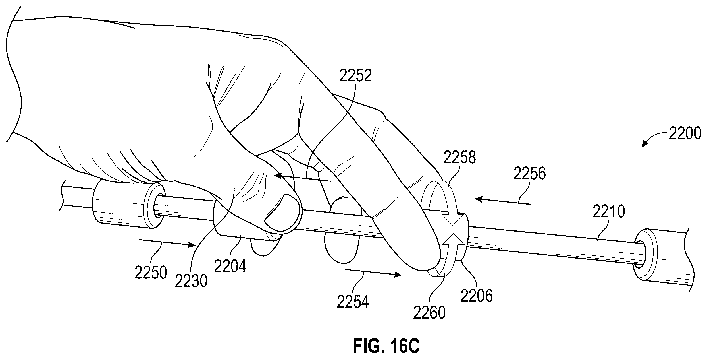 Patent US12564414 Figure 18 – Method of supra-aortic access for a neurovascular procedure