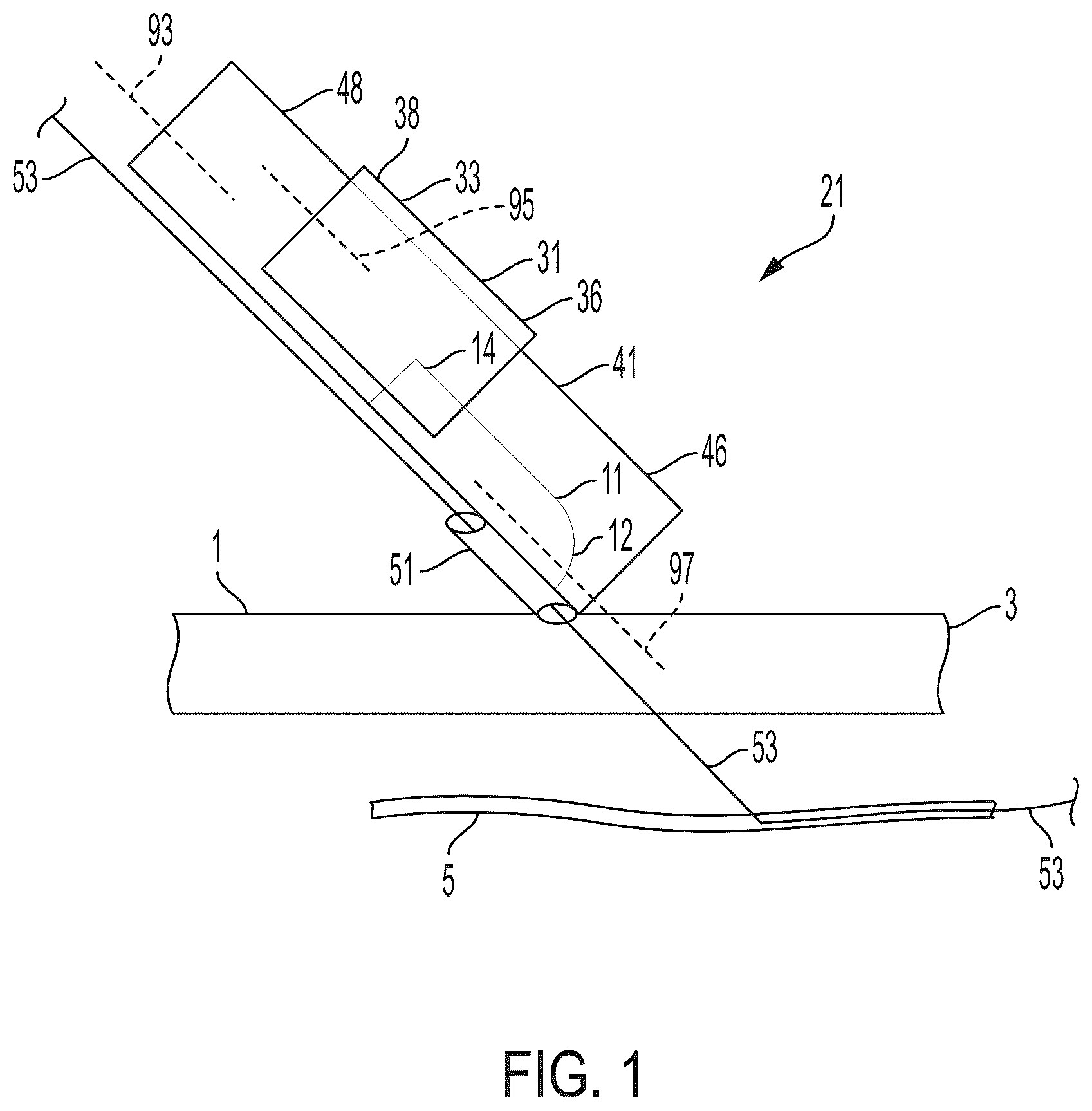 Patent US12564419 — Surgical incision apparatus and related methods thereof — Figure 1